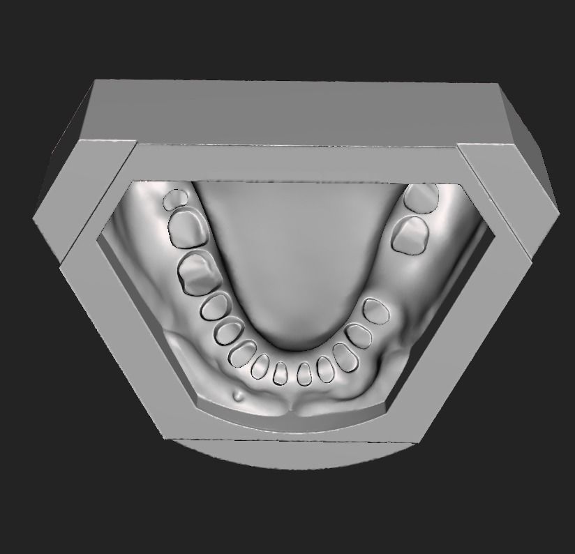 D005 Mold for making silicone gum of Oral surgery model 3D print model_9