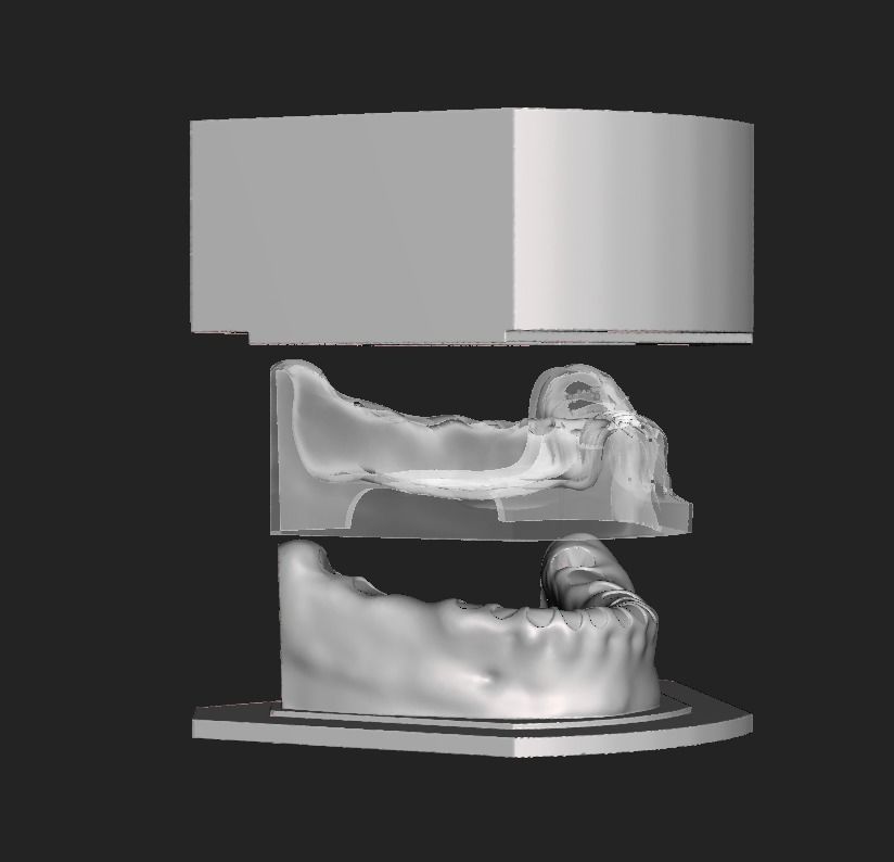 D005 Mold for making silicone gum of Oral surgery model 3D print model_1