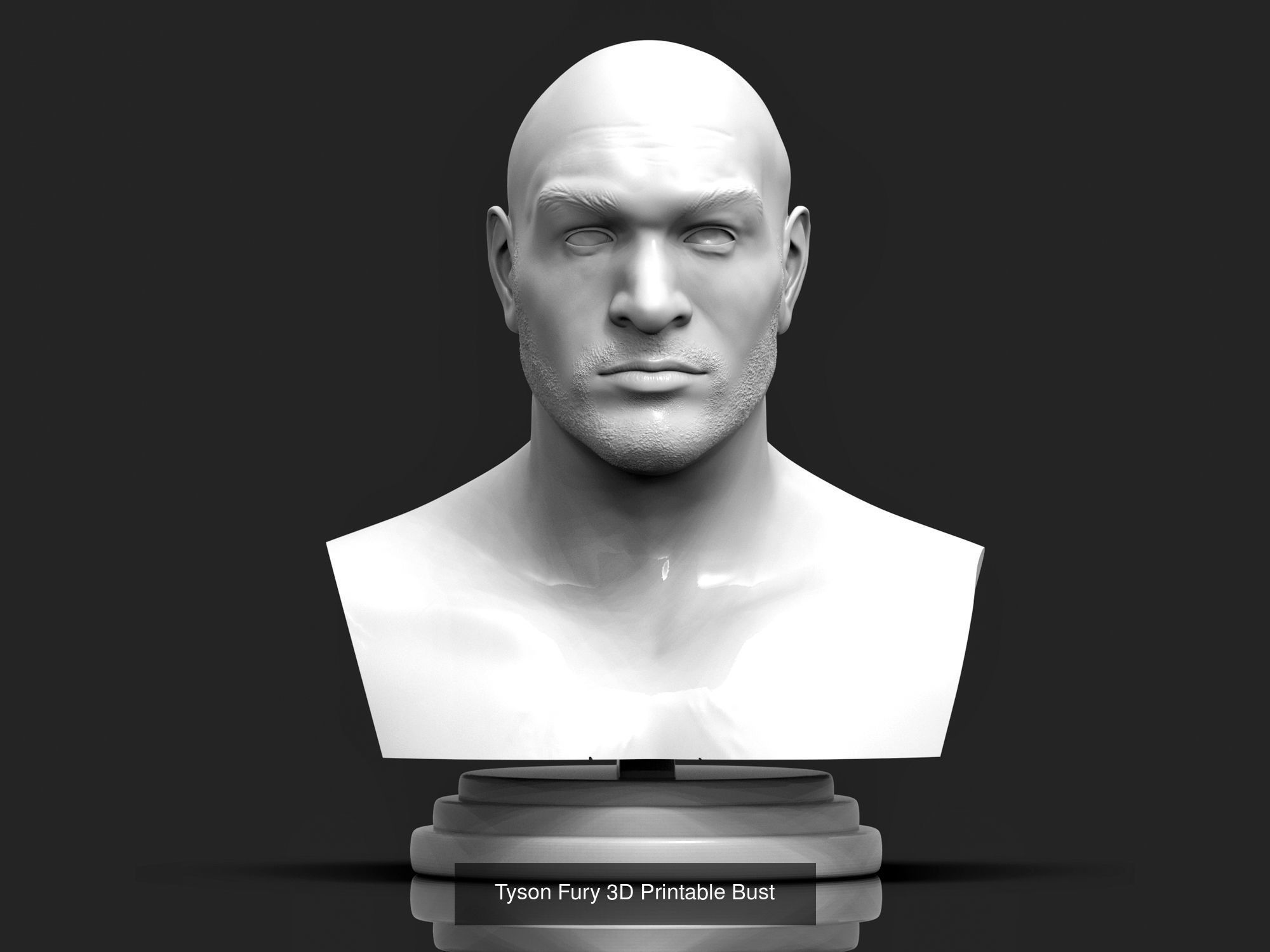 Tyson Fury Collection _3