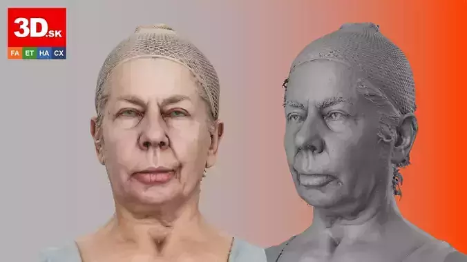 Raw Head Scan Abigail Morris