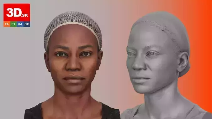 Raw Head Scan Bshara Henry