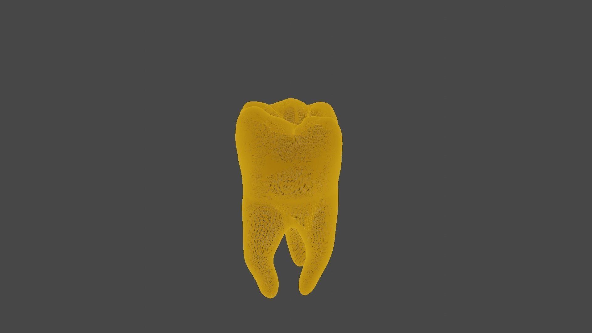 Maxillary first  molar human tooth 3D model_8