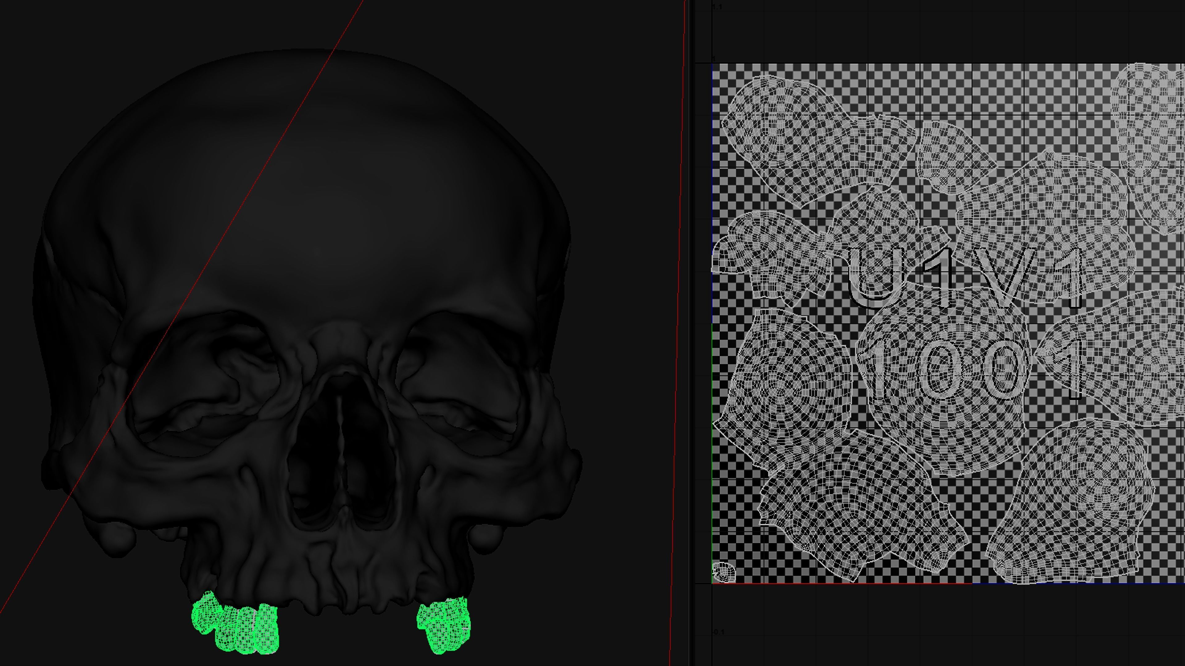 Photorealistic Skull with parietal trauma 3D model_13