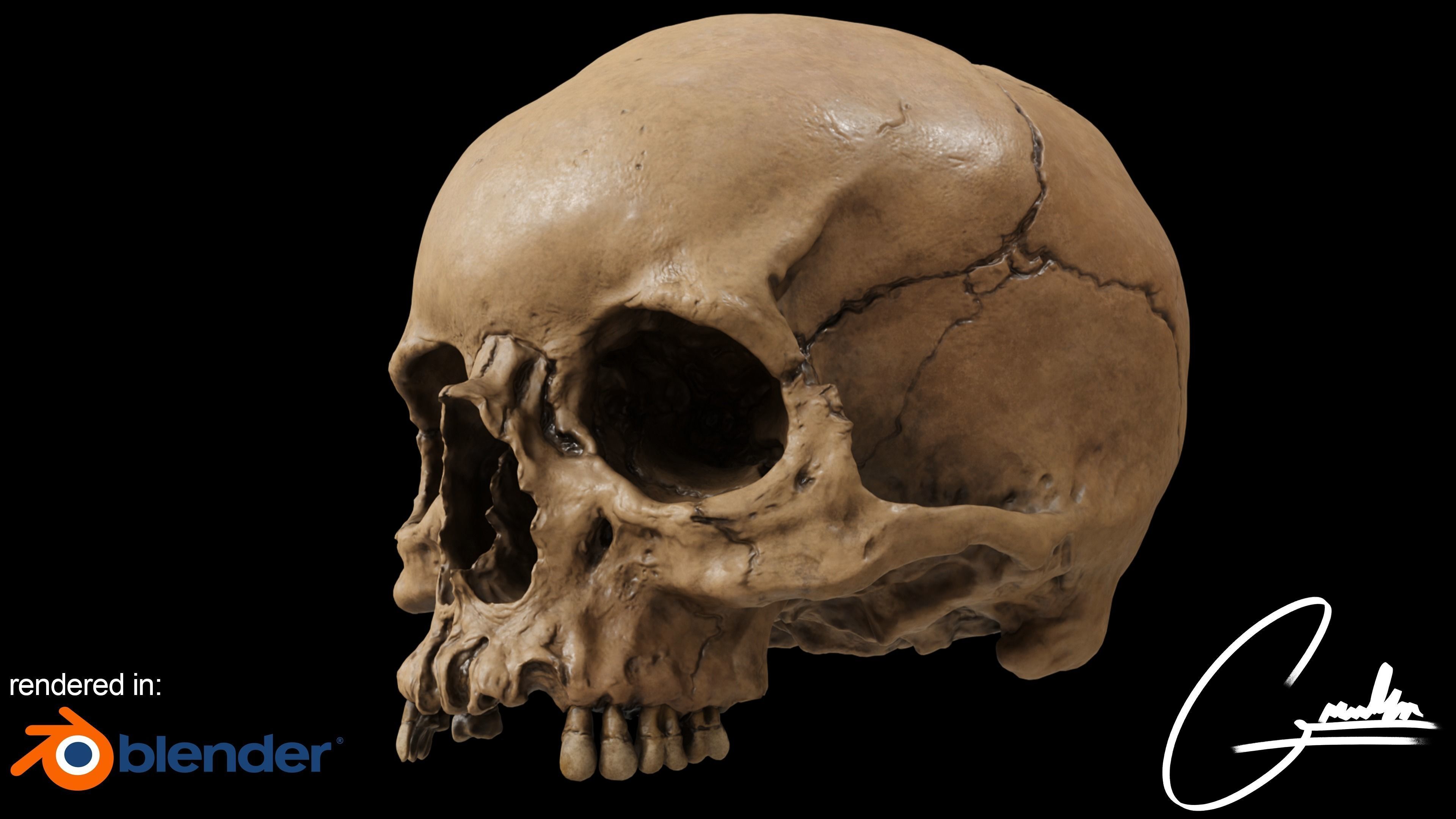Photorealistic Skull with parietal trauma 3D model_8