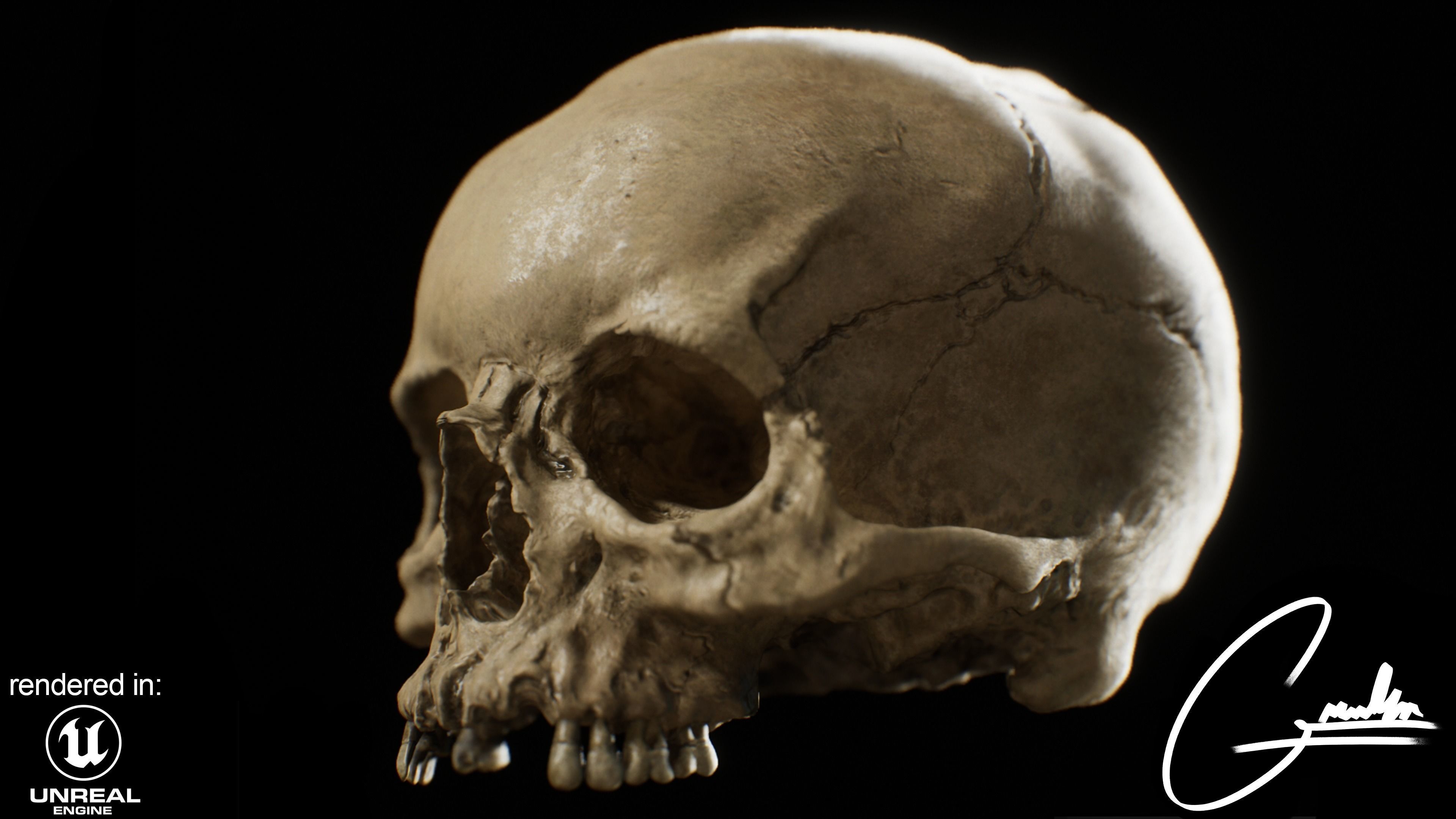 Photorealistic Skull with parietal trauma 3D model_7