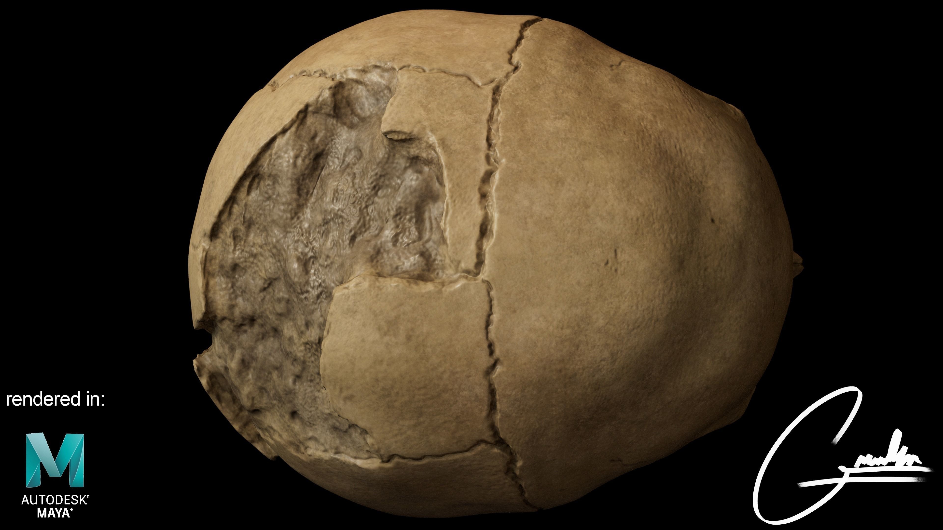 Photorealistic Skull with parietal trauma 3D model_5