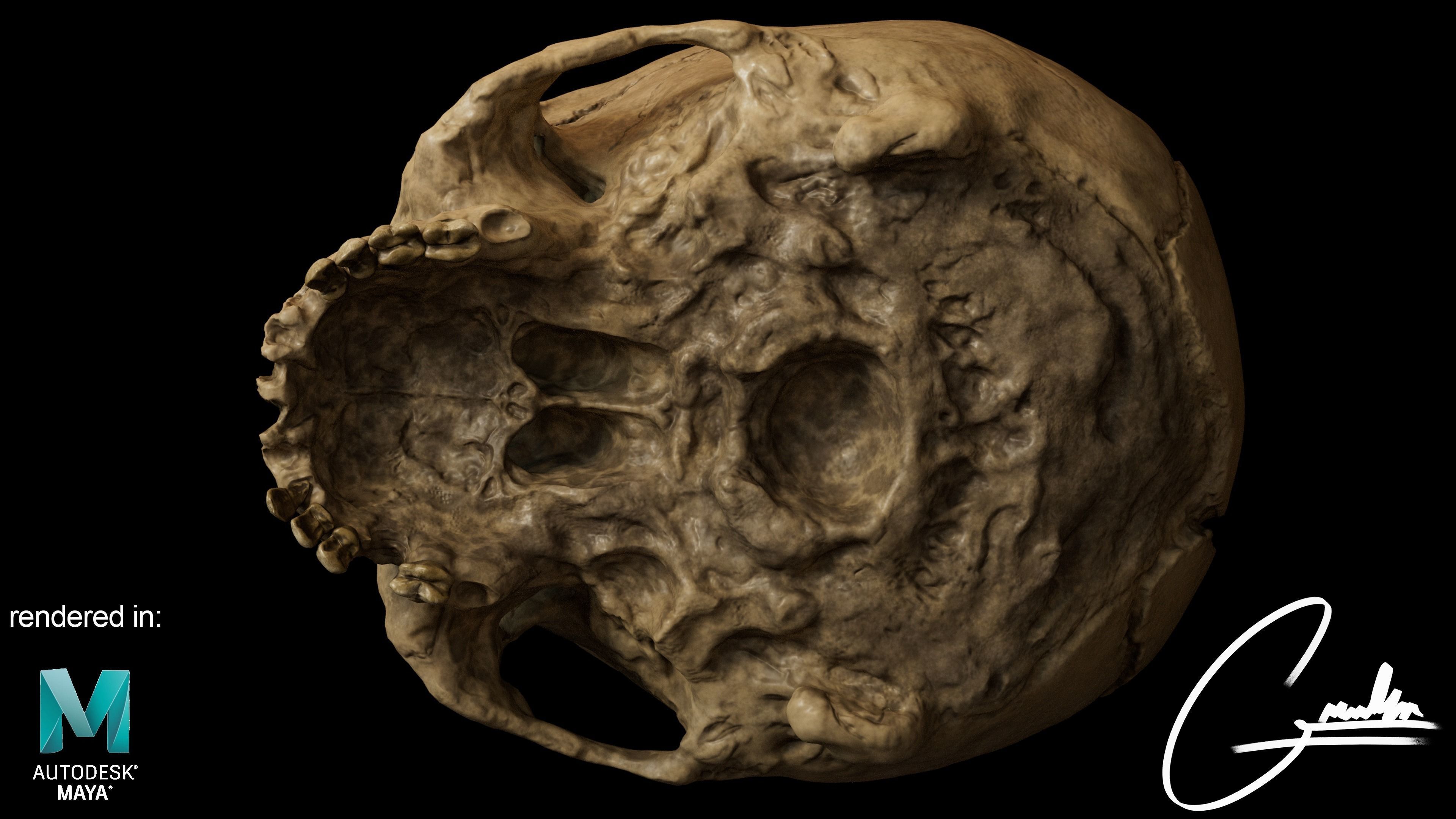Photorealistic Skull with parietal trauma 3D model_6