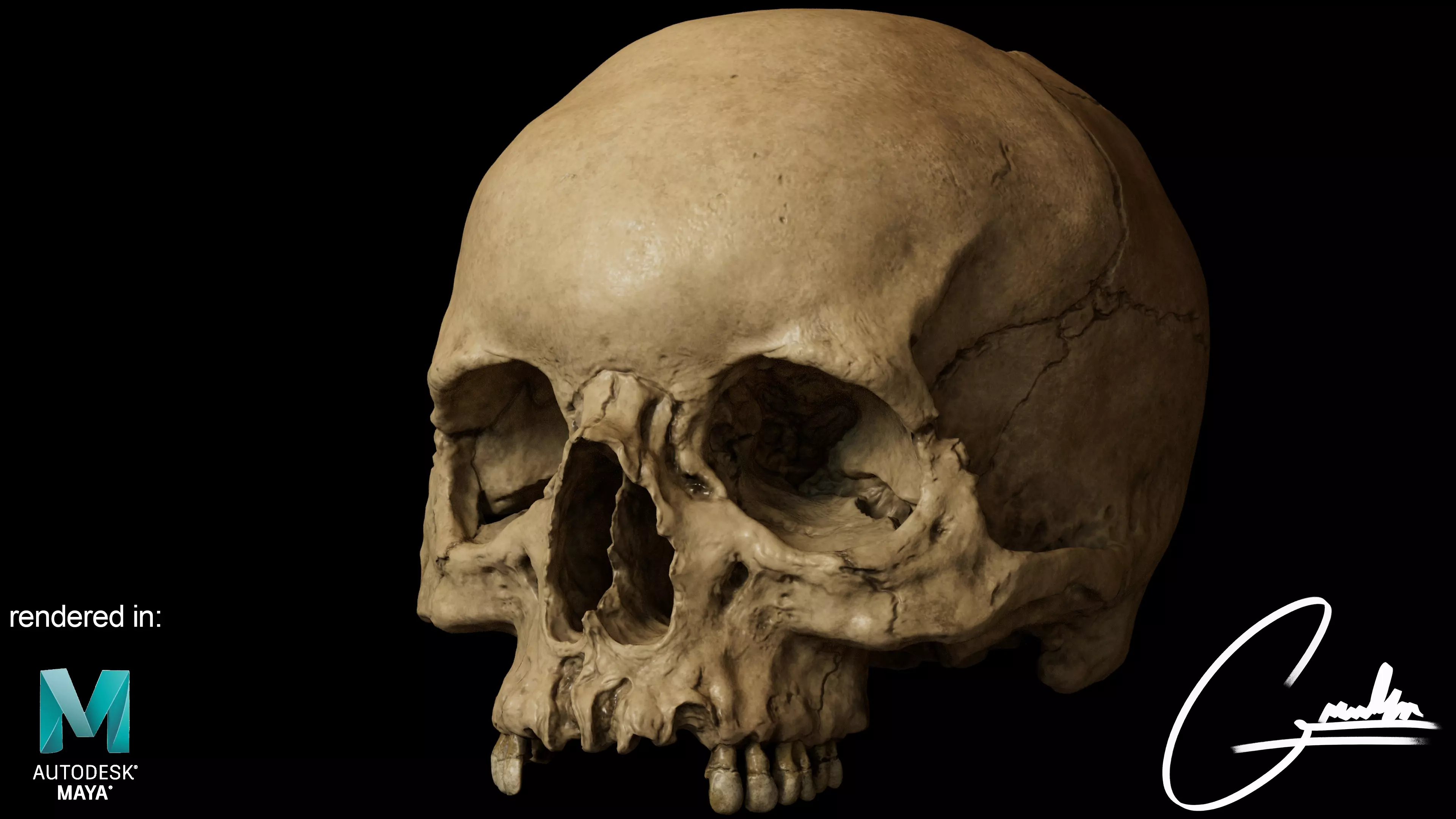 Photorealistic Skull with parietal trauma 3D model_0