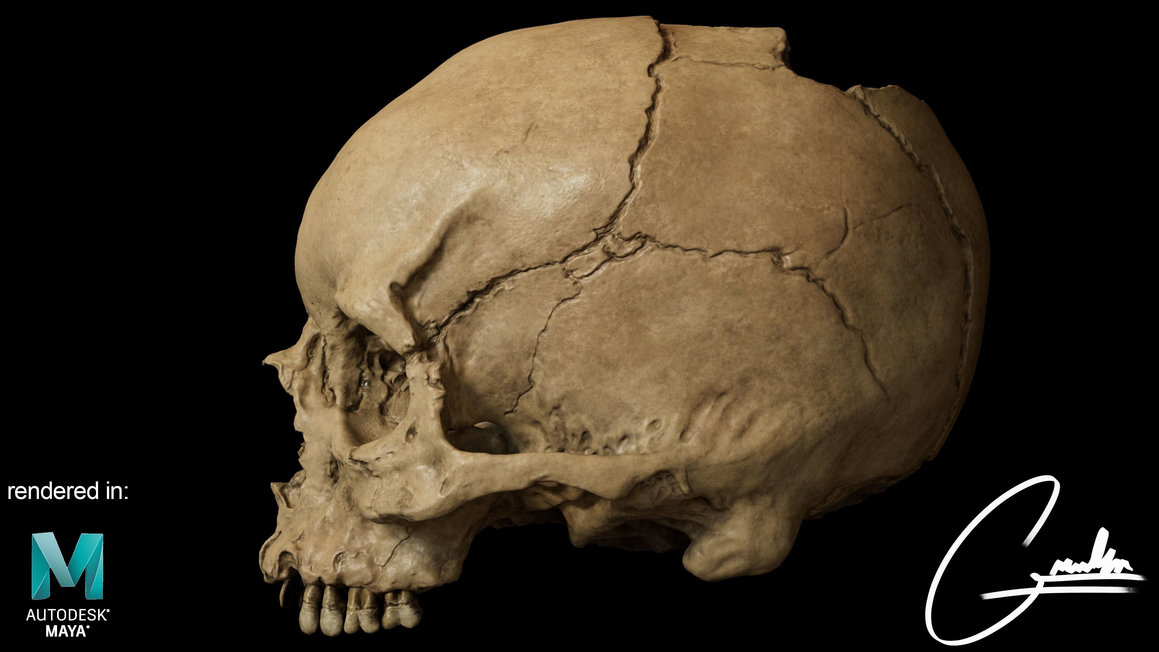 Photorealistic Skull with parietal trauma 3D model_4