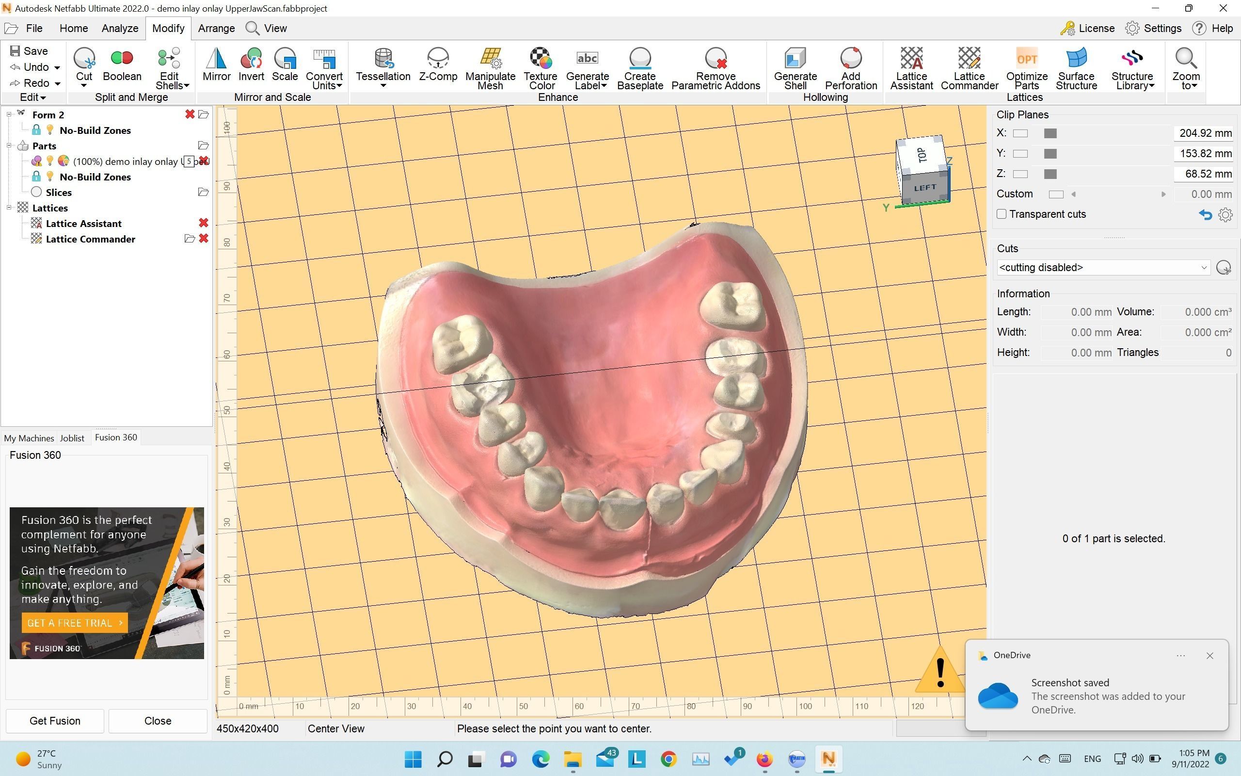 Demo model for exocad   3shape   3d print  3D print model_5