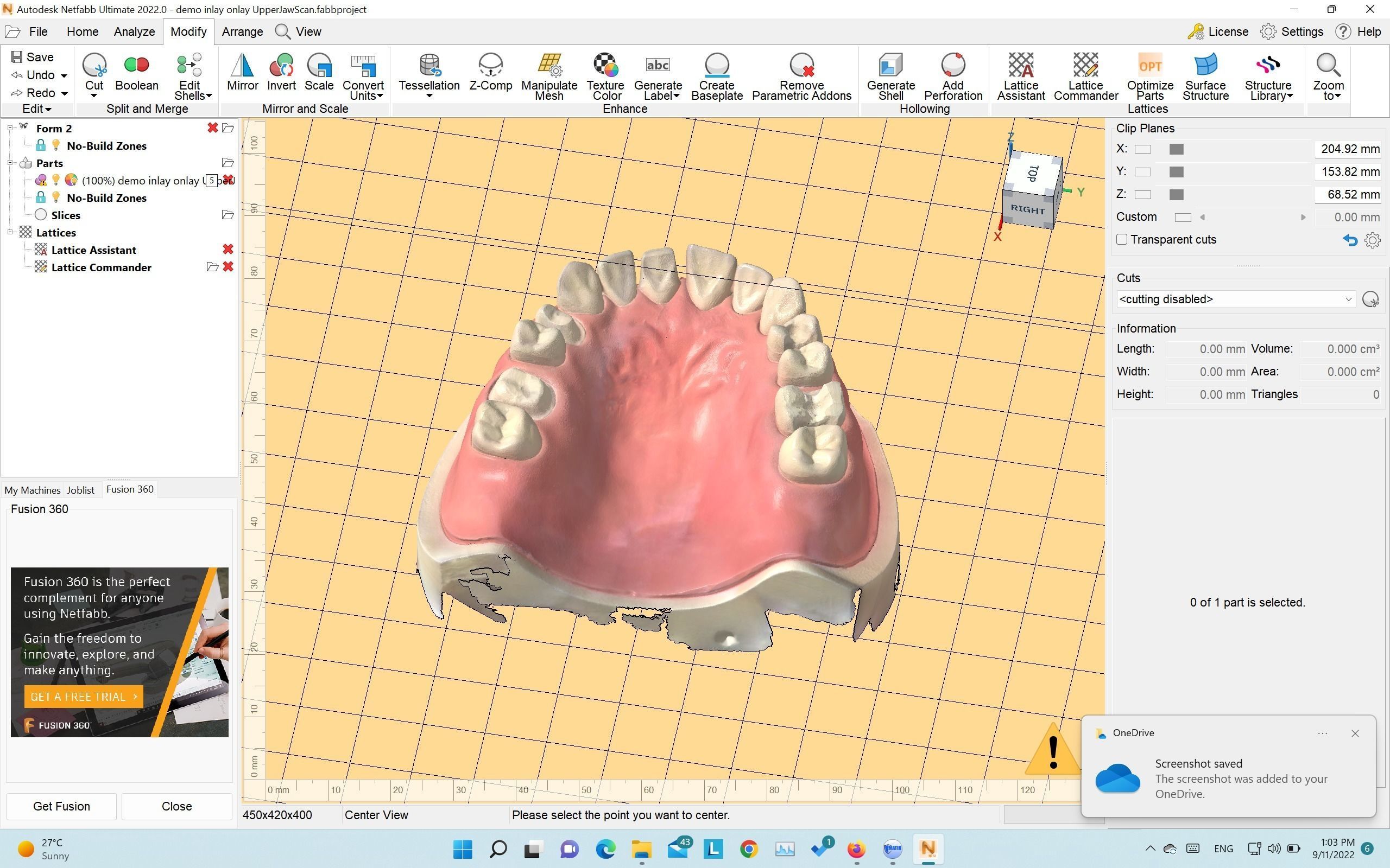 Demo model for exocad   3shape   3d print  3D print model_2