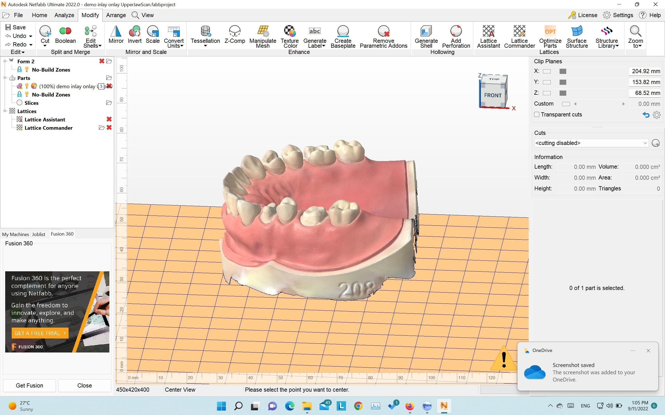 Demo model for exocad   3shape   3d print  3D print model_6