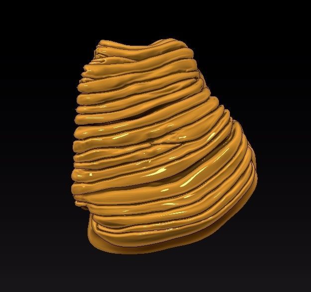 the cerebellar vermis 3D print model_3