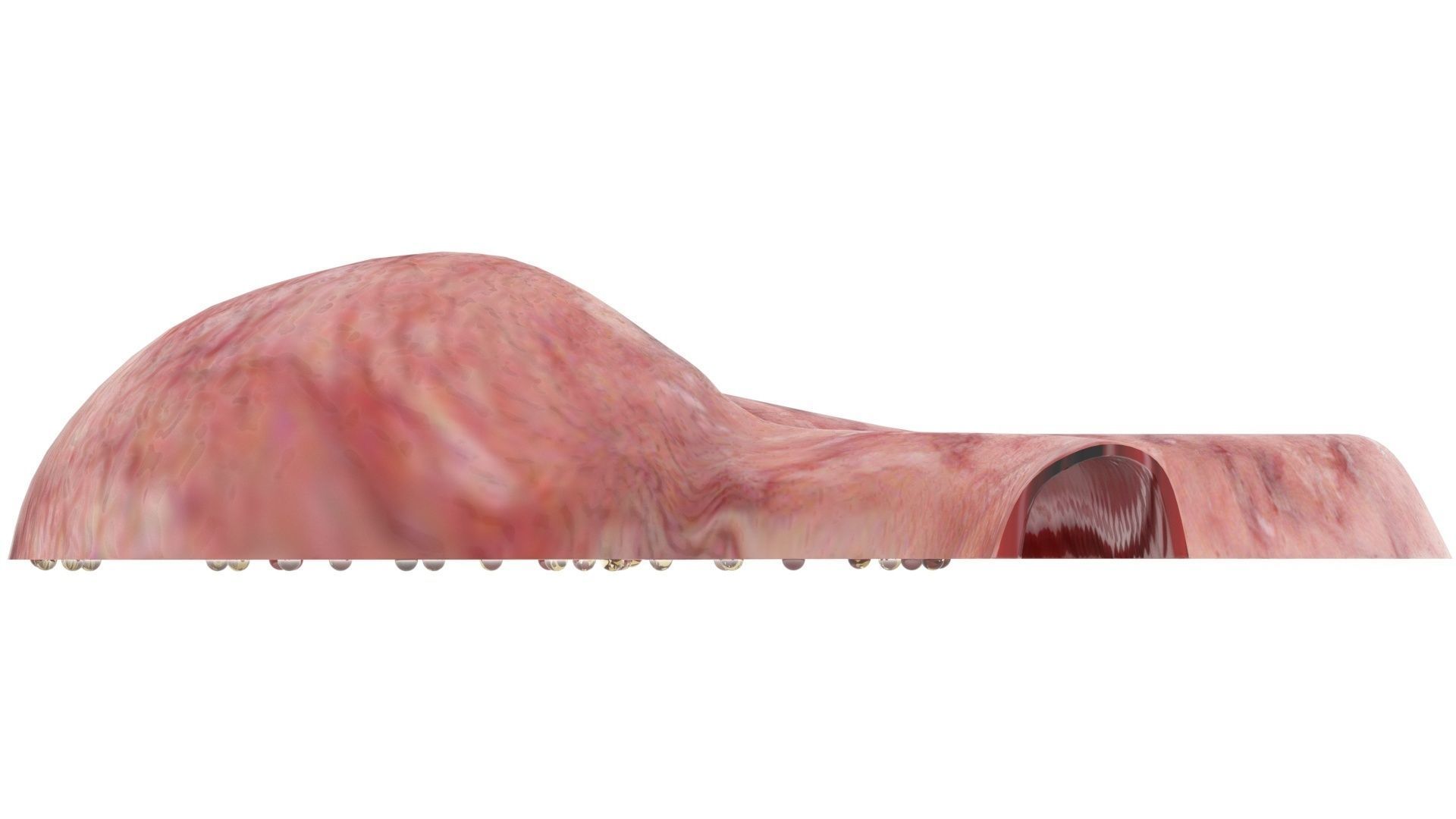 Gastric Acid In Stomach 3D model_12