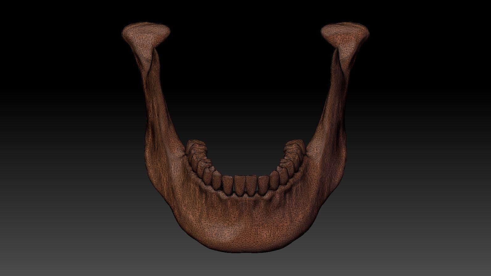 Skull 3d Print model human 3D print model_26