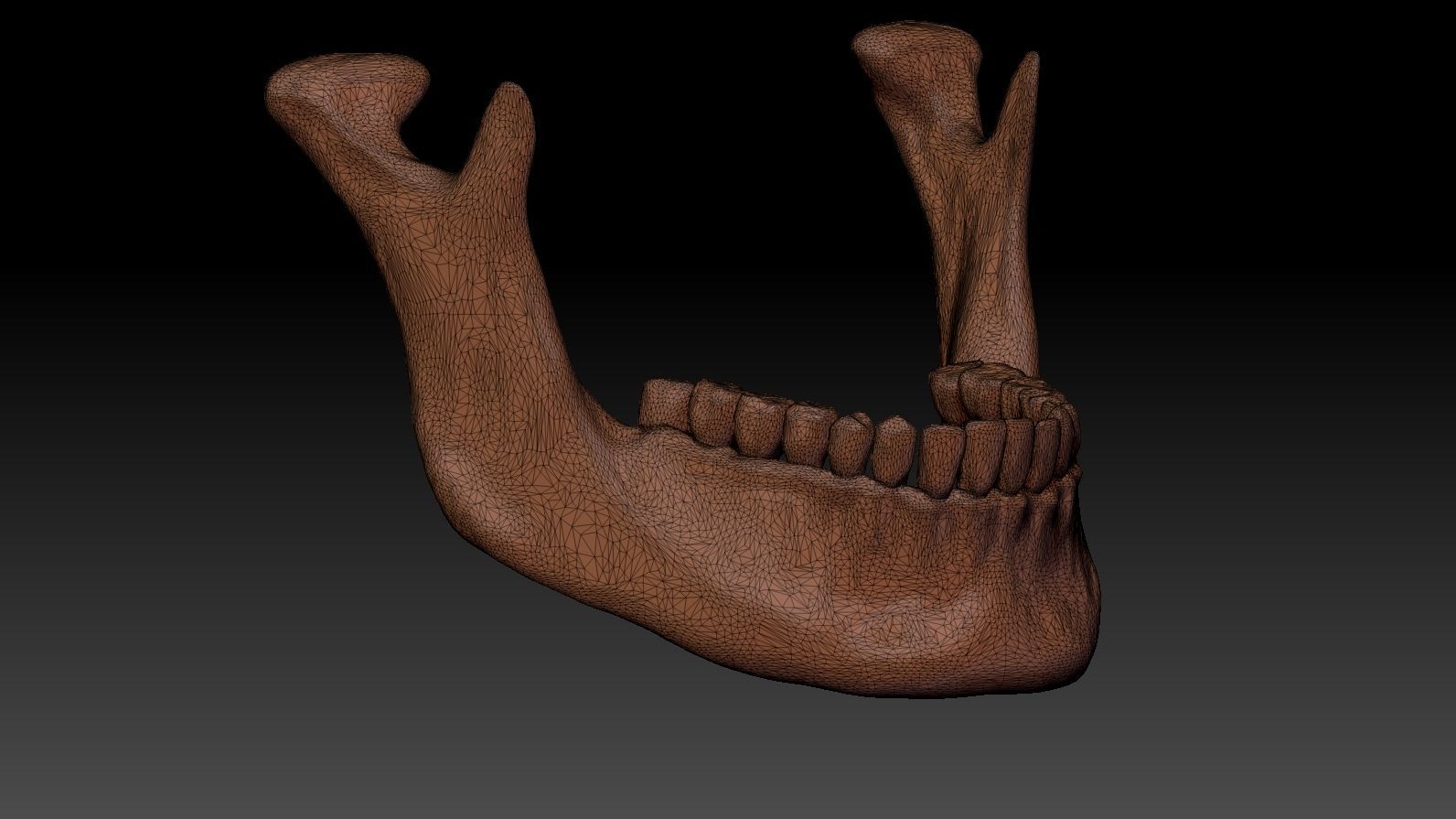 Skull 3d Print model human 3D print model_25