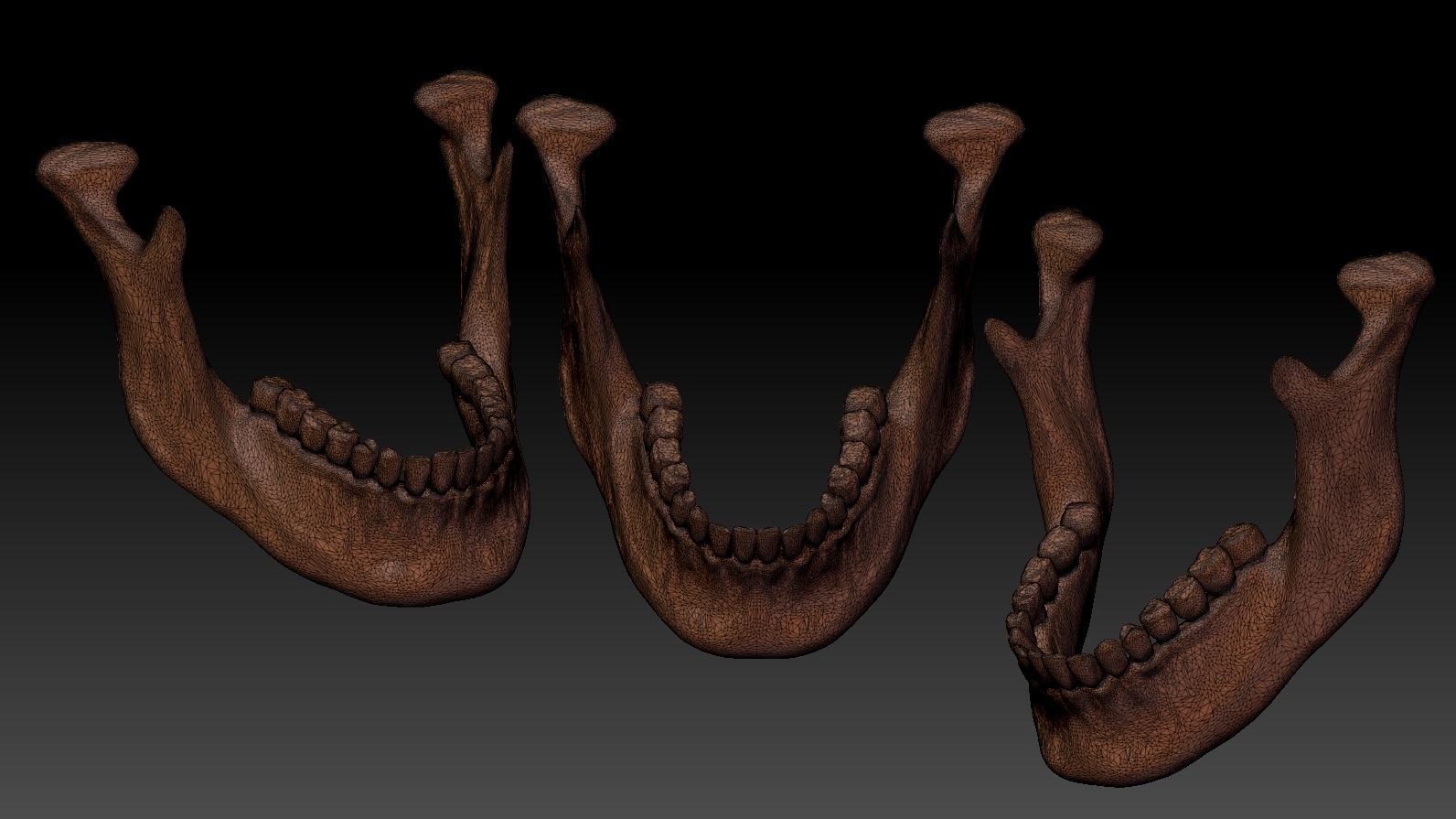 Skull 3d Print model human 3D print model_28