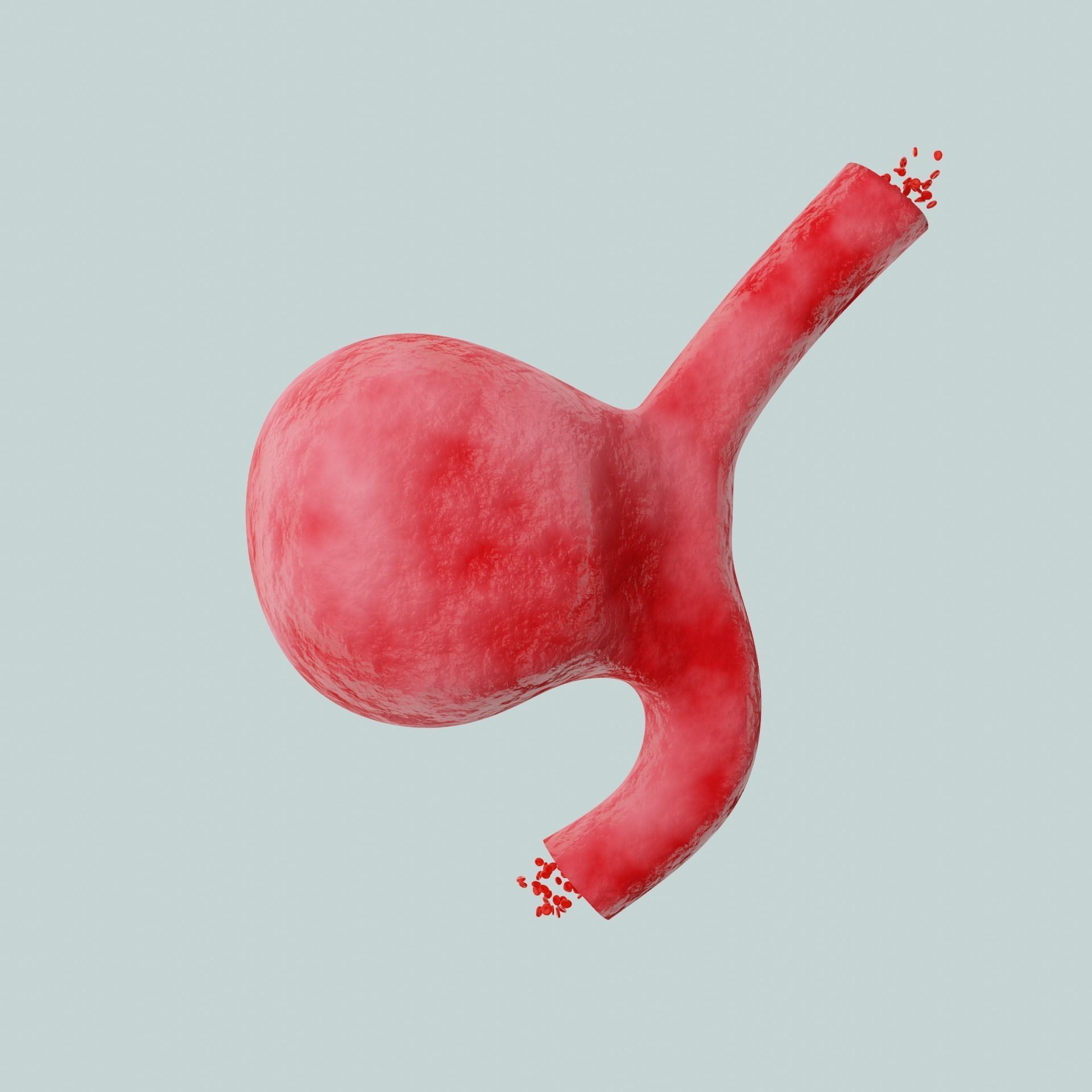 Aneurysm ruptured photorealistic animated  Low-poly 3D model_2
