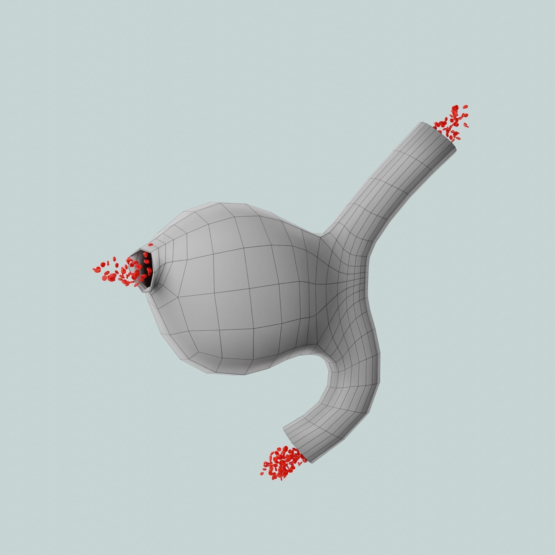 Aneurysm ruptured photorealistic animated  Low-poly 3D model_7
