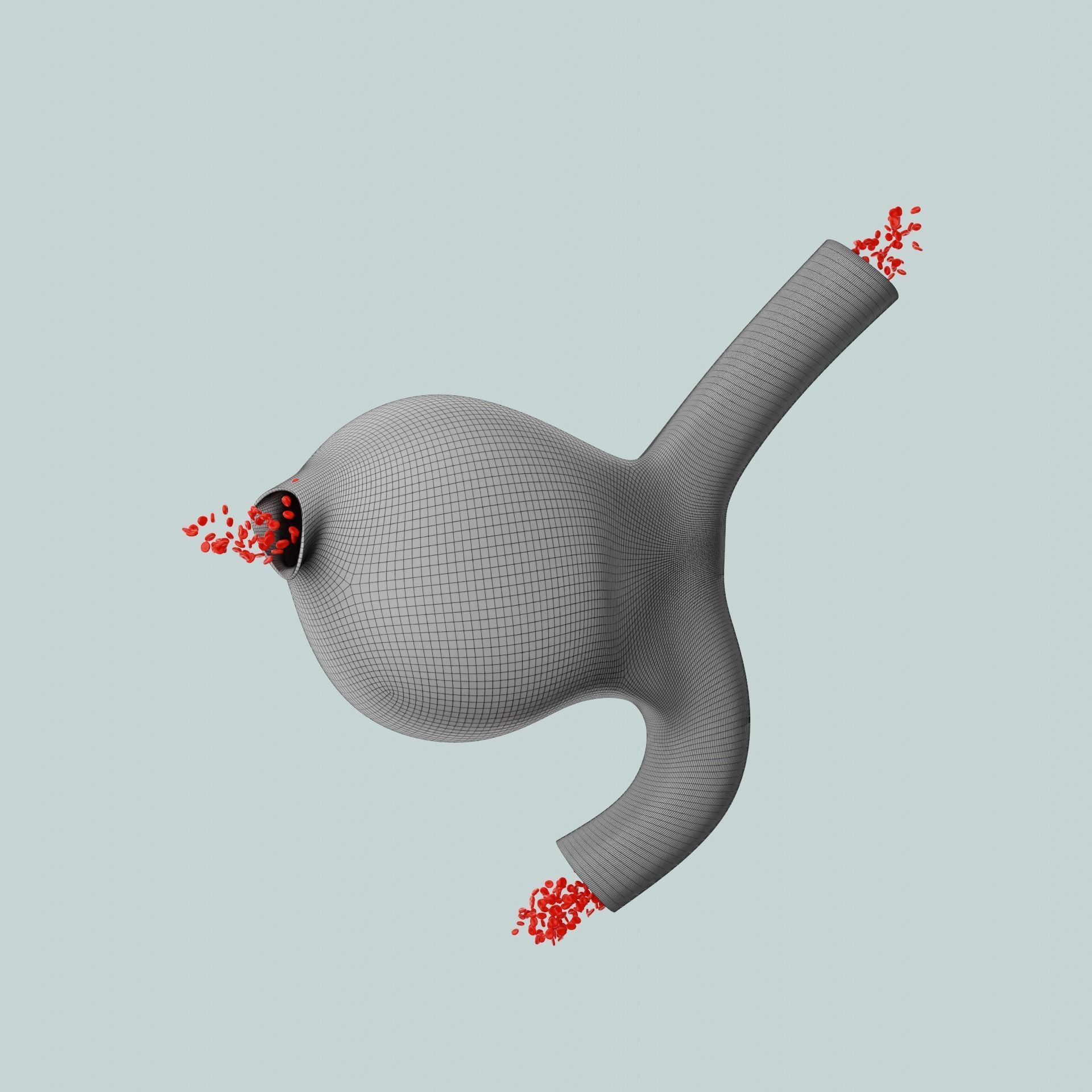 Aneurysm ruptured photorealistic animated  Low-poly 3D model_8