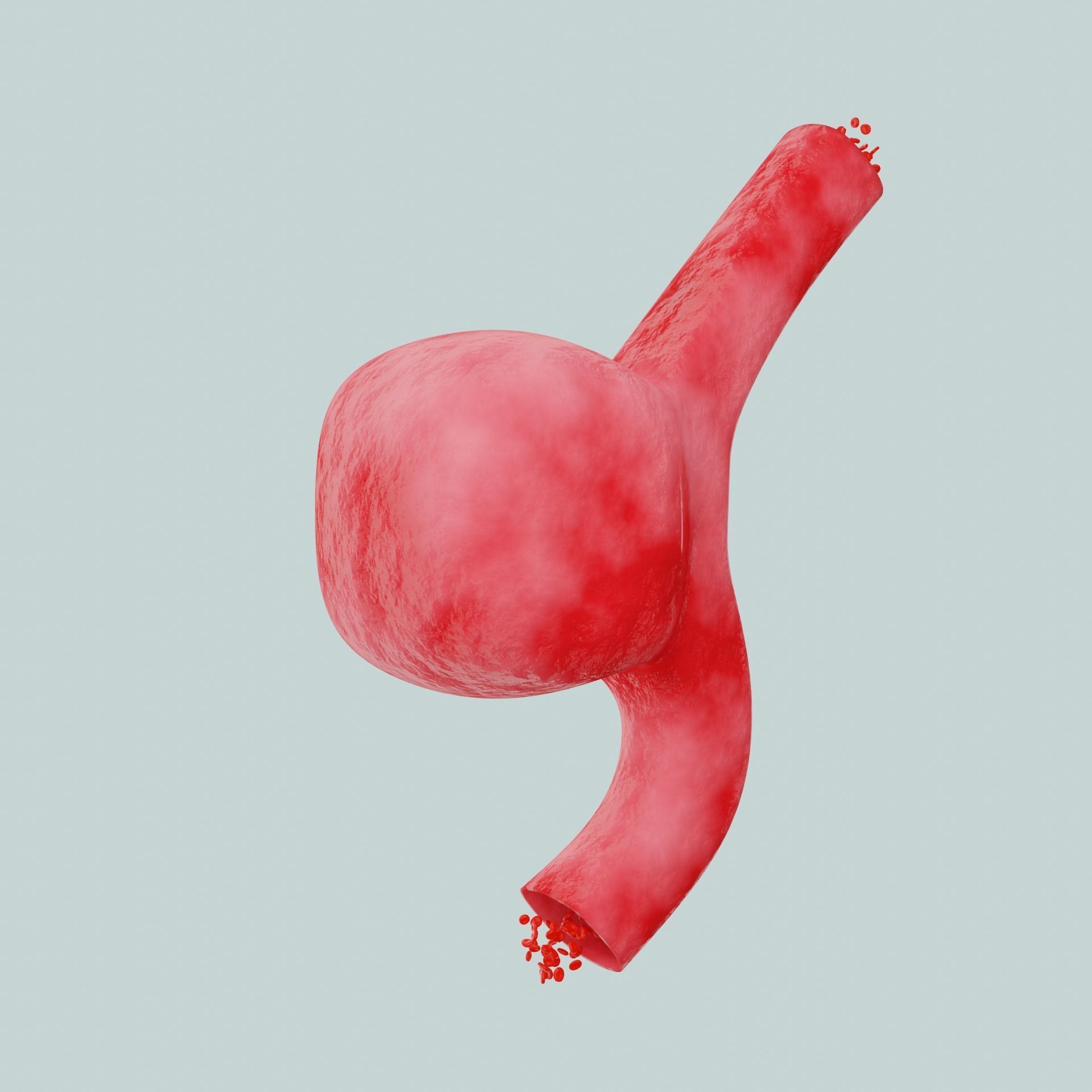 Aneurysm ruptured photorealistic animated  Low-poly 3D model_3