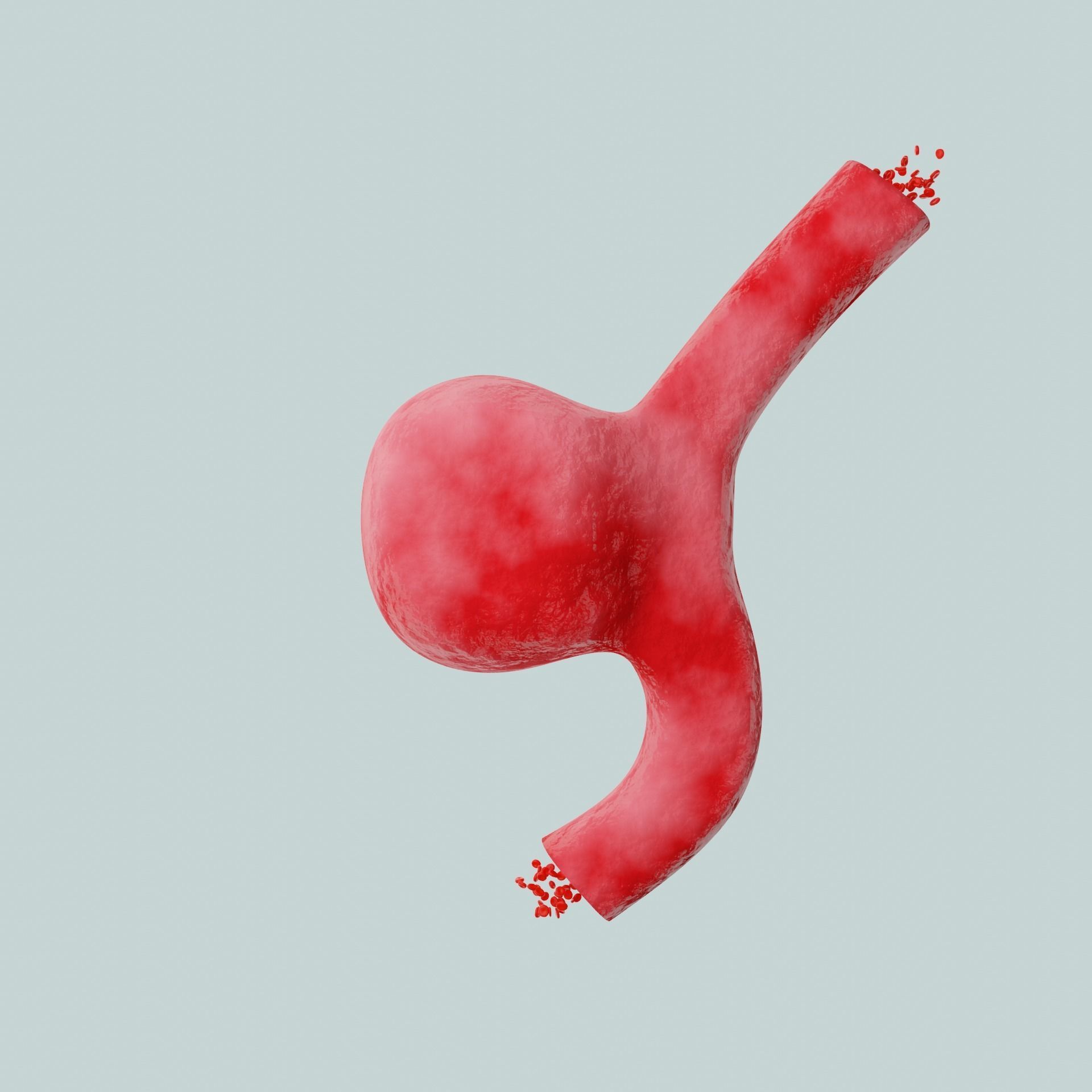 Aneurysm ruptured photorealistic animated  Low-poly 3D model_1