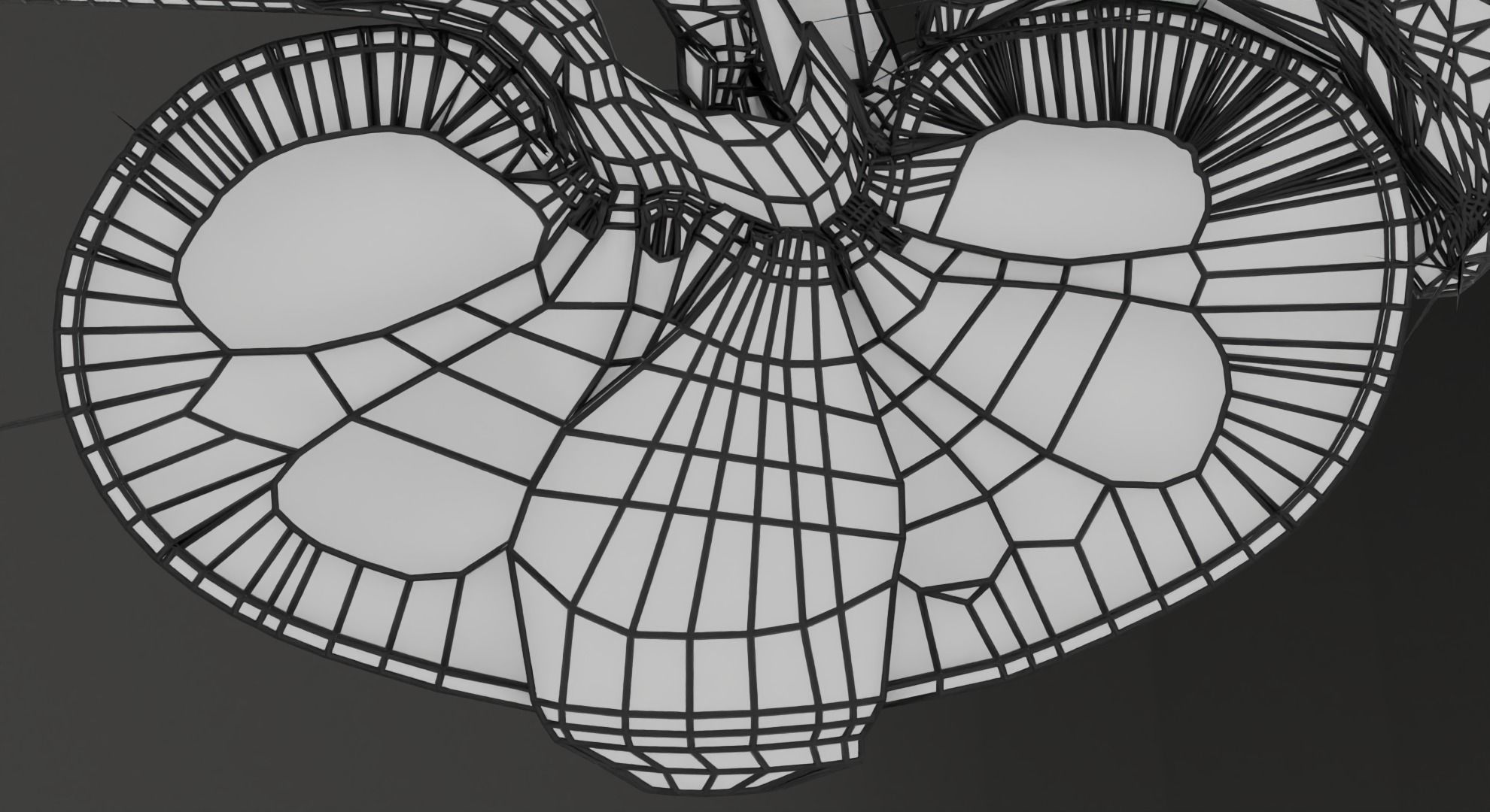 Renal cell carcinoma 3D model_28