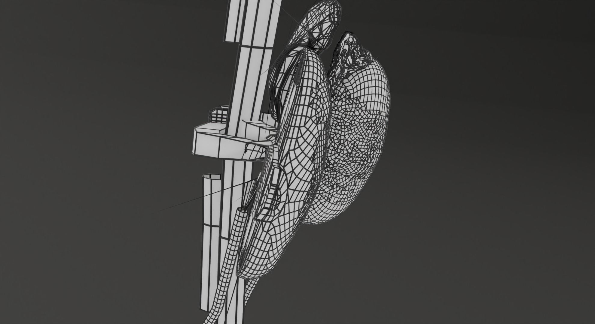 Renal cell carcinoma 3D model_22