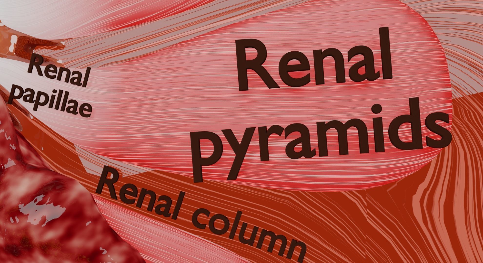 Renal cell carcinoma 3D model_17