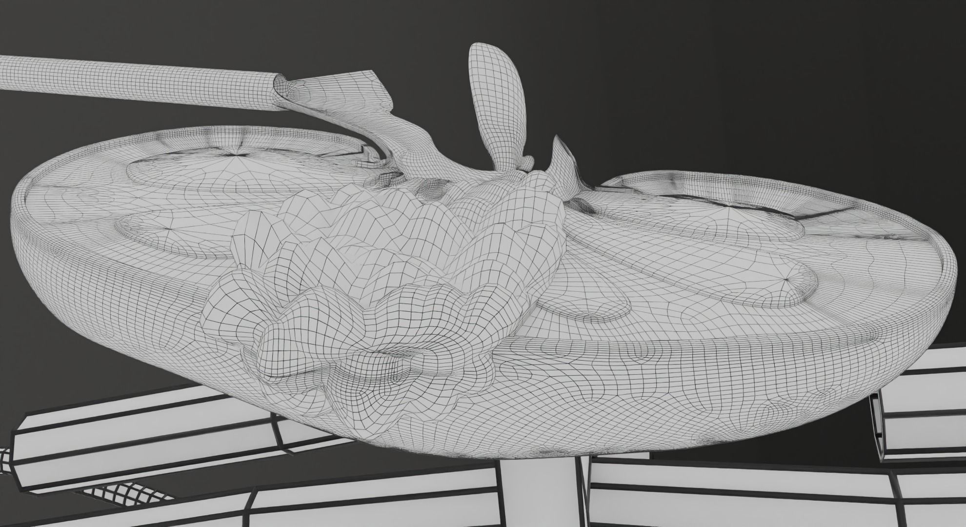 Renal cell carcinoma 3D model_25