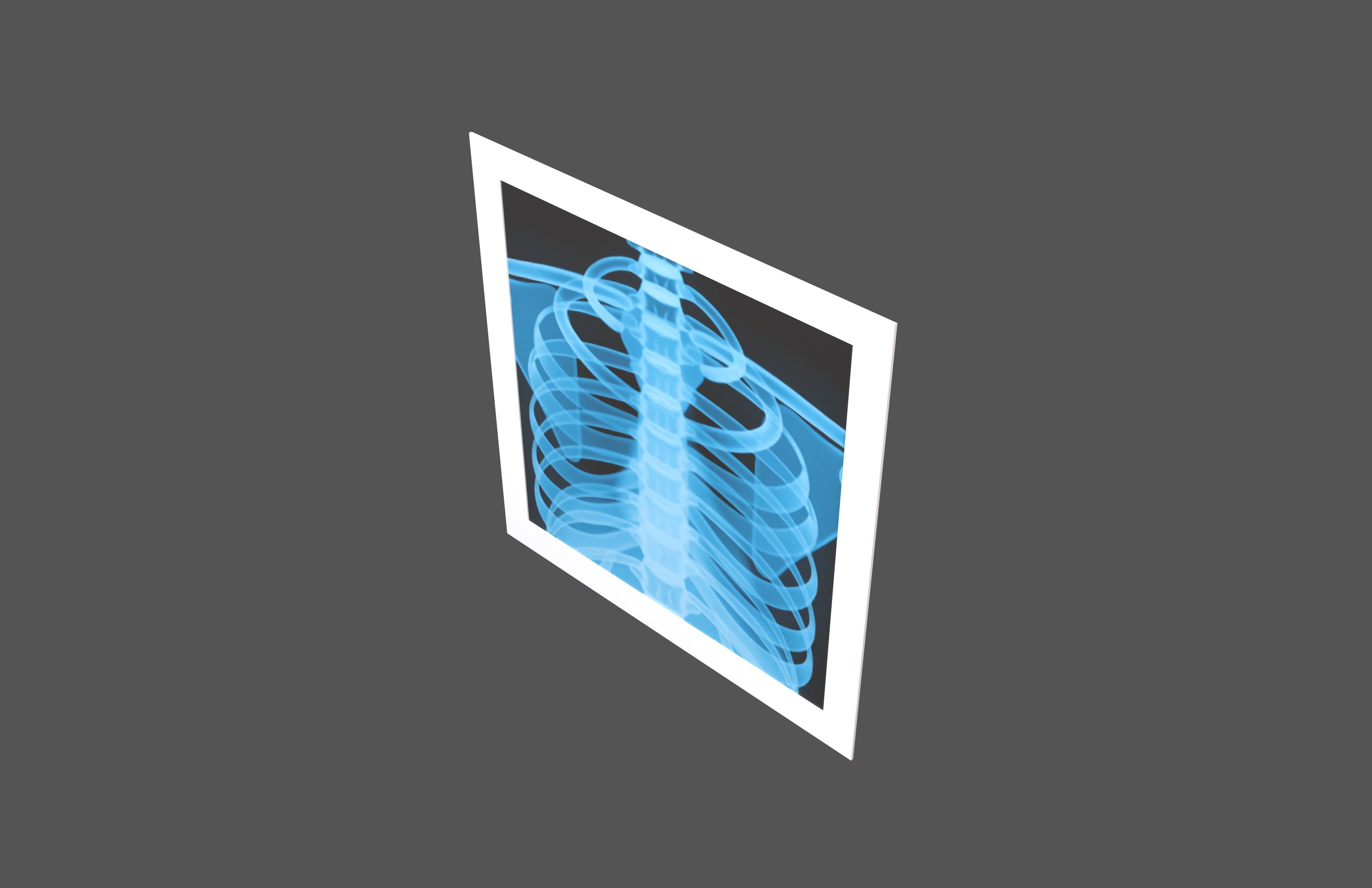 X-Ray Emoji v1 001 Low-poly 3D model_1