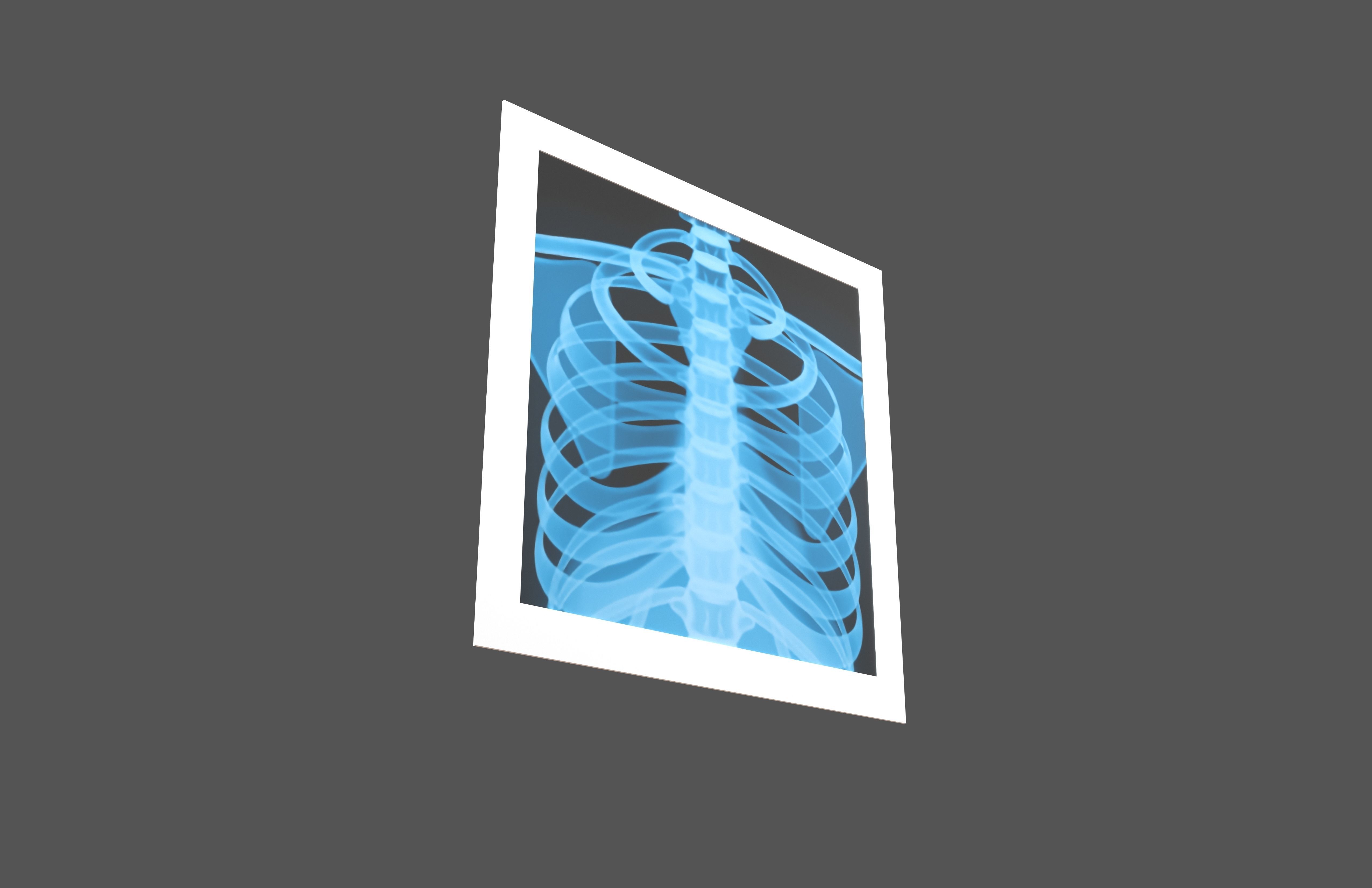 X-Ray Emoji v1 001 Low-poly 3D model_3