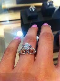 YD 28 3D print model_18