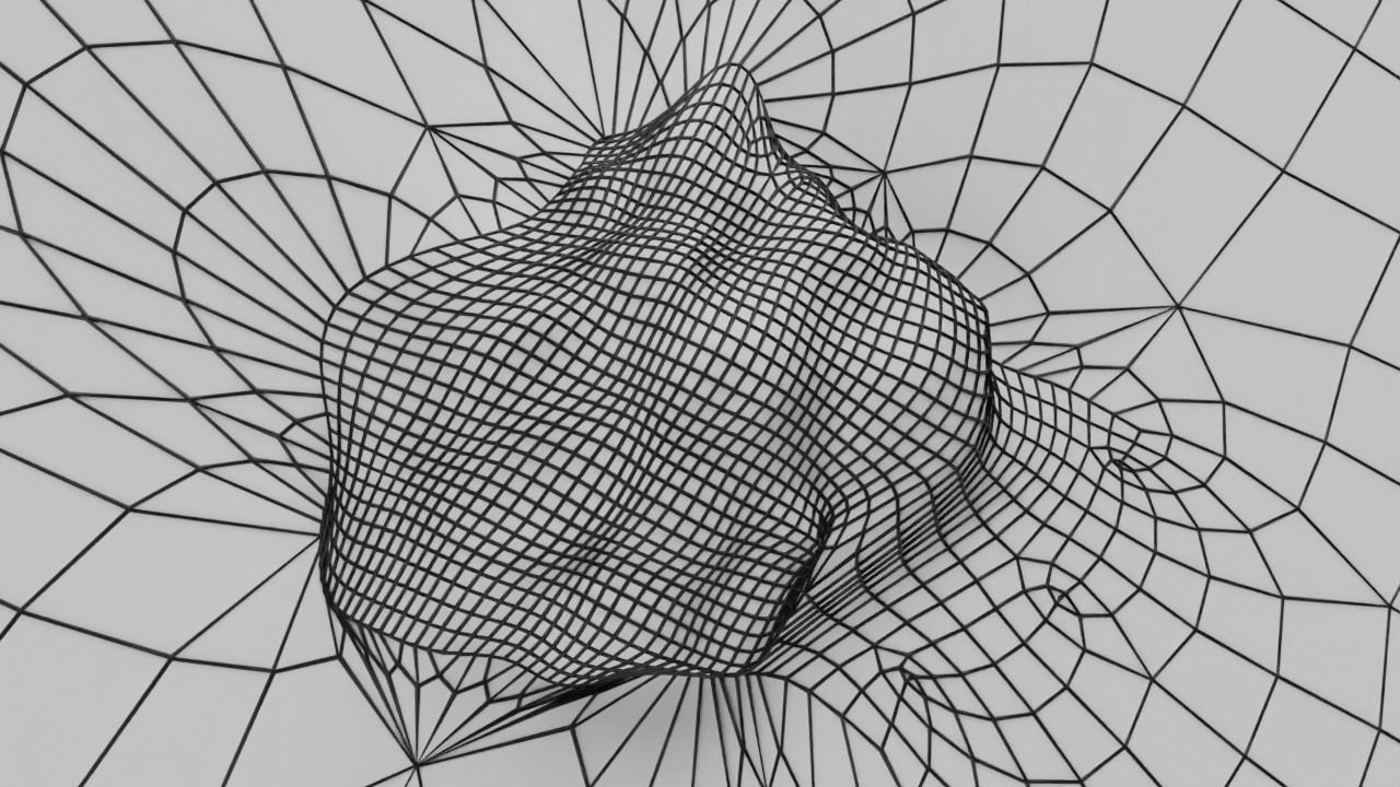 Mole nevus cancer Malignant melanoma differences 3D model_16