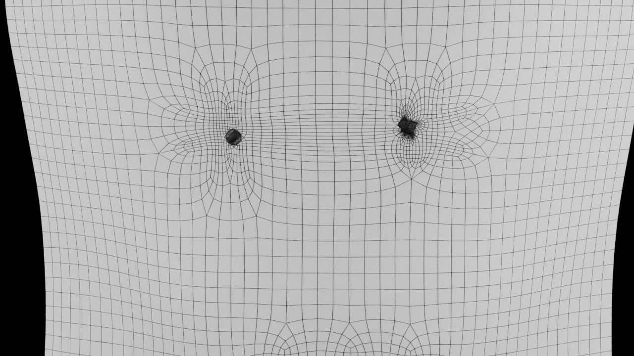 Mole nevus cancer Malignant melanoma differences 3D model_14