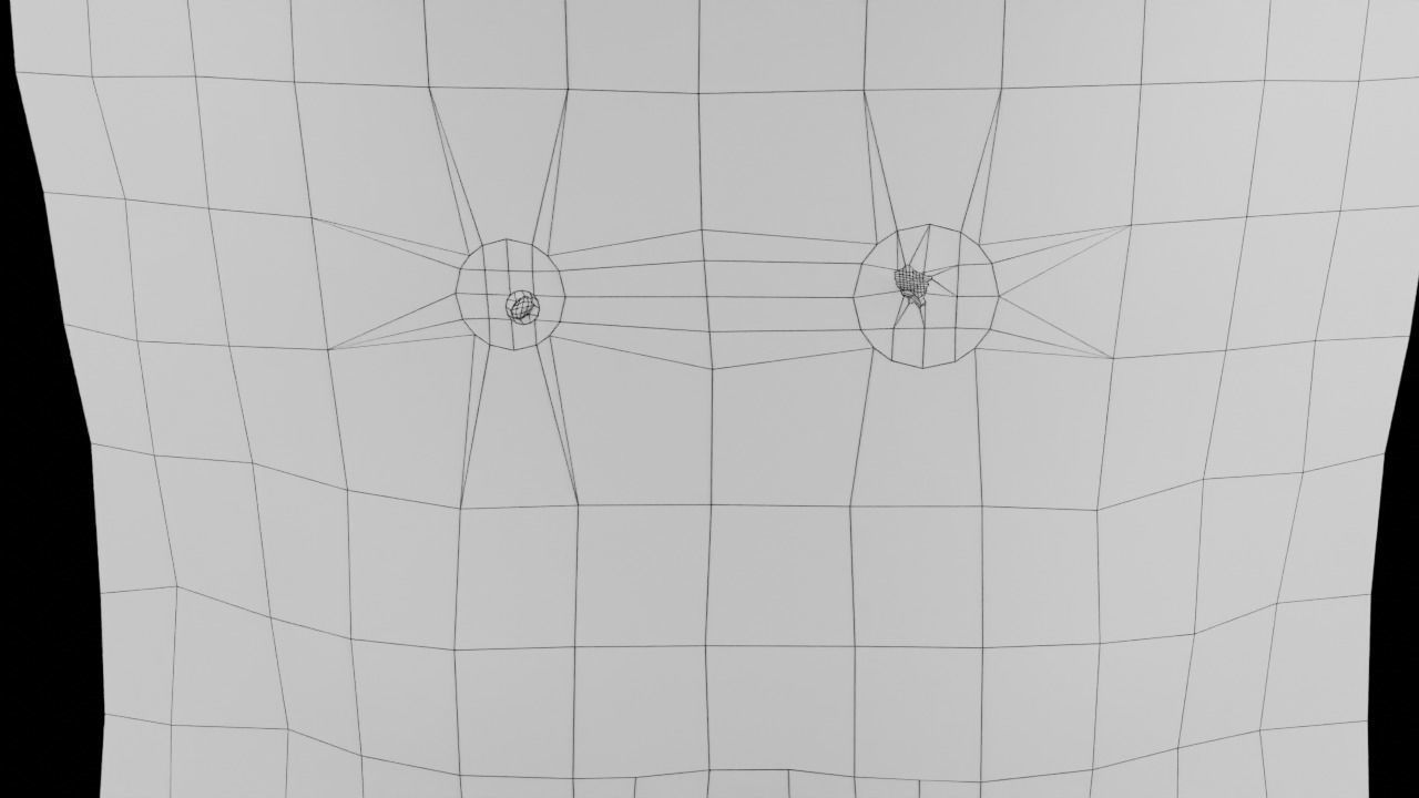 Mole nevus cancer Malignant melanoma differences 3D model_19