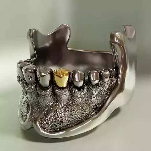 Jaw ring