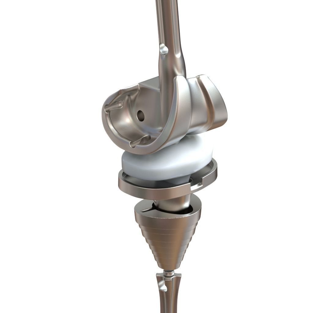 Knee Replacement Implant 3D model_2