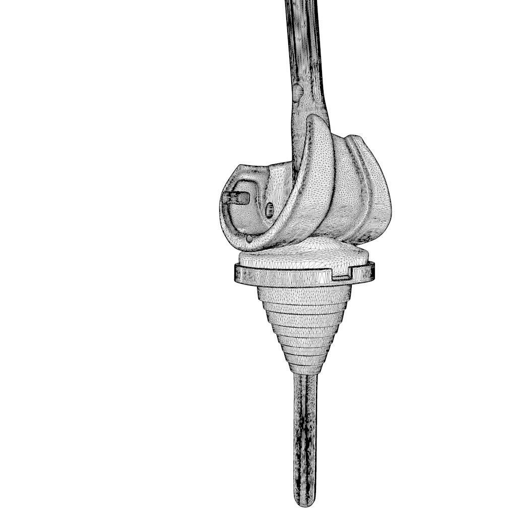 Knee Replacement Implant 3D model_10