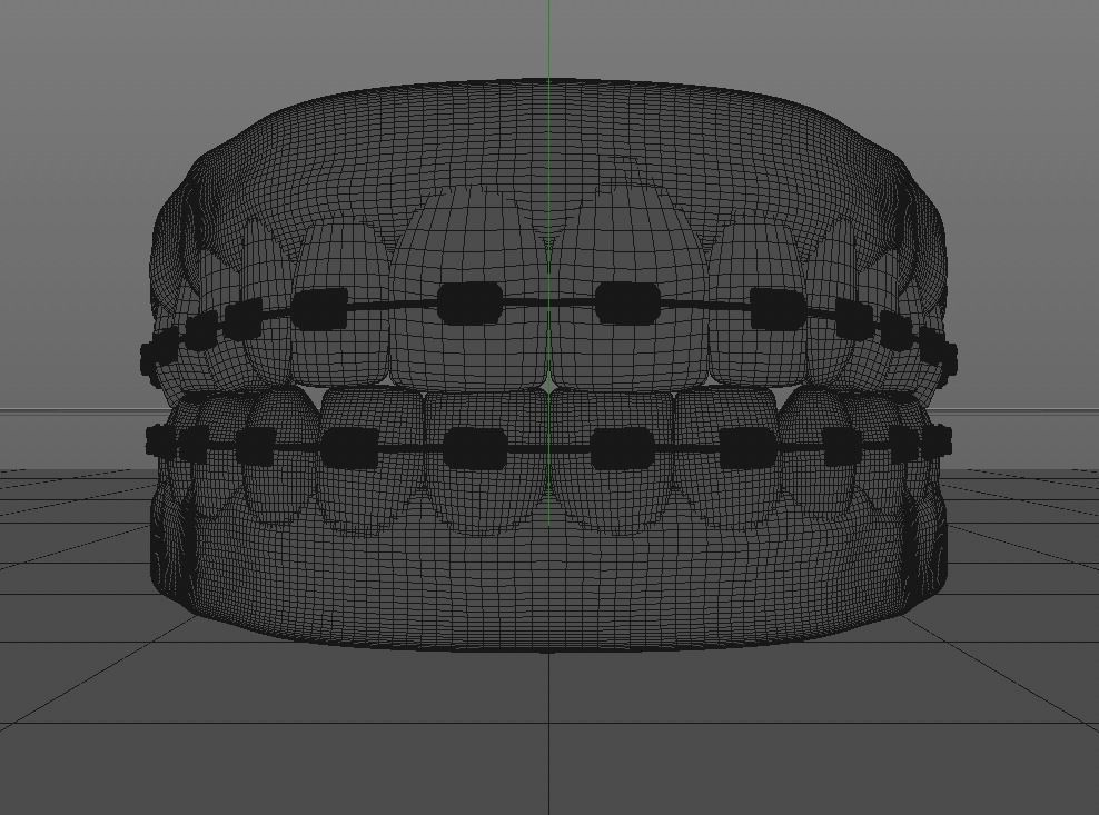 Fake Teeth And Braces 3D model | CGTrader