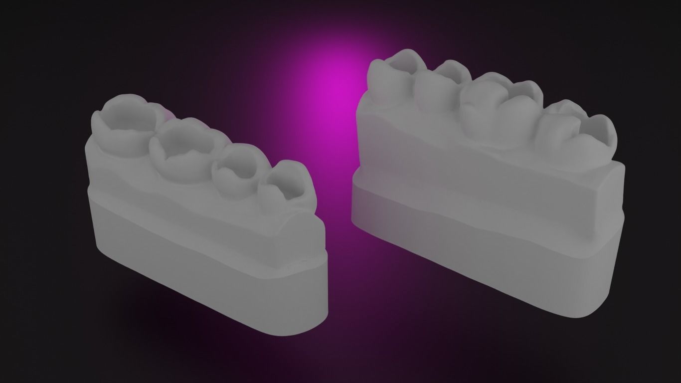 Guidline in composite filling 3D print model_1