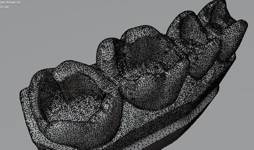 Guidline in composite filling 3D print model_3