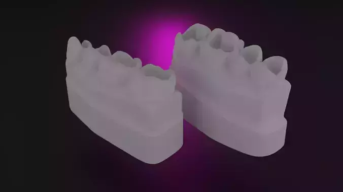 Guidline in composite filling 3D print model