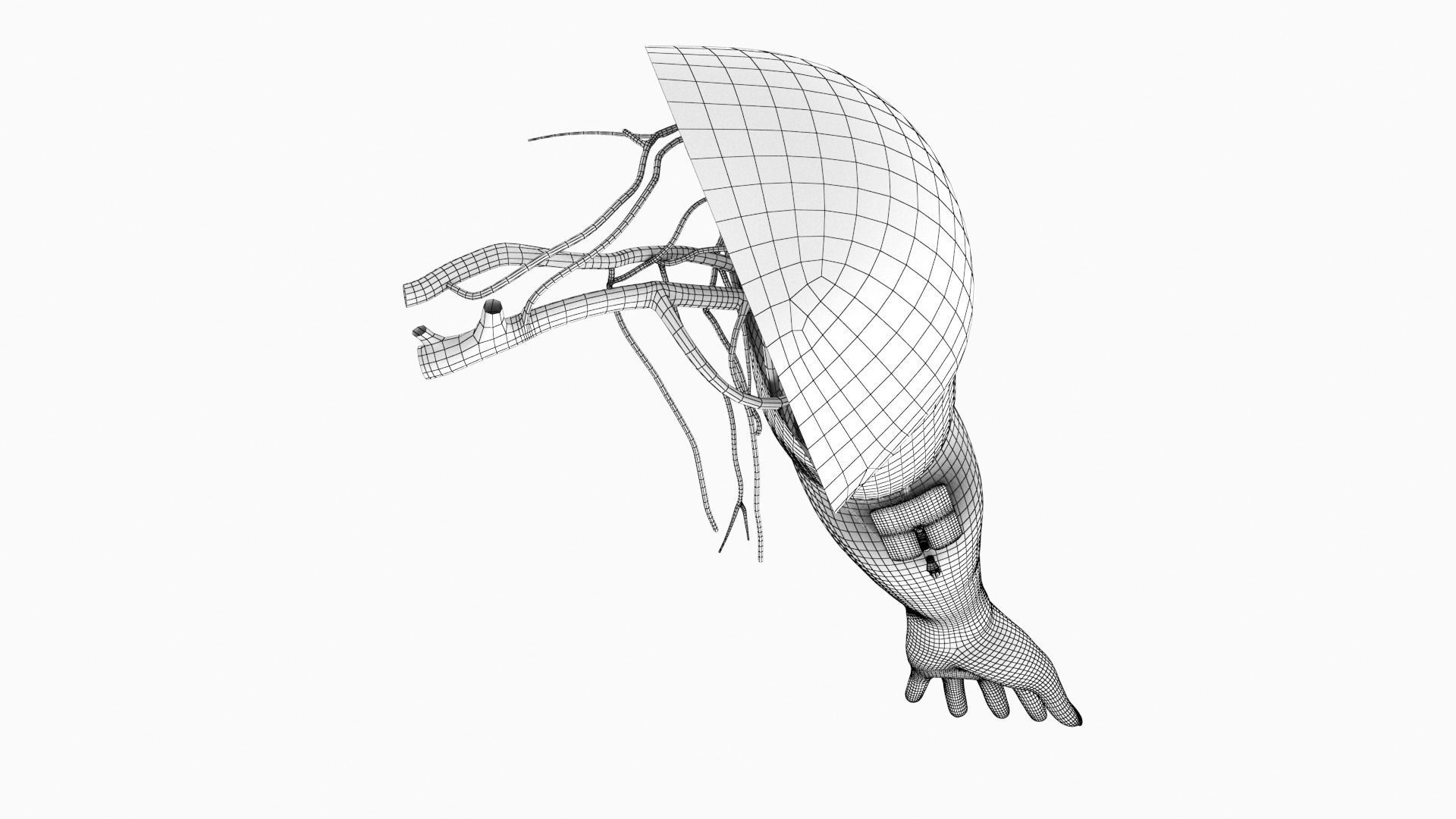 Injected Cannula with sticking plaster Low-poly 3D model_13