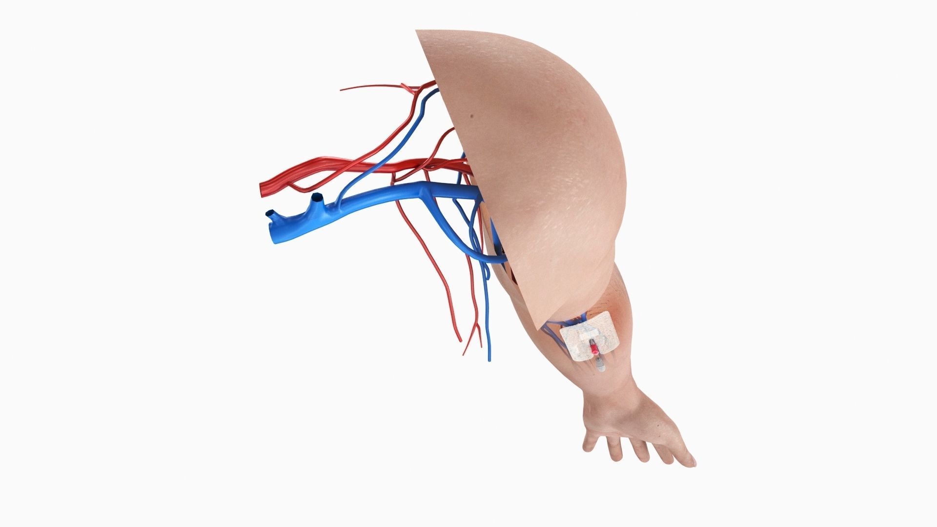 Injected Cannula with sticking plaster Low-poly 3D model_7