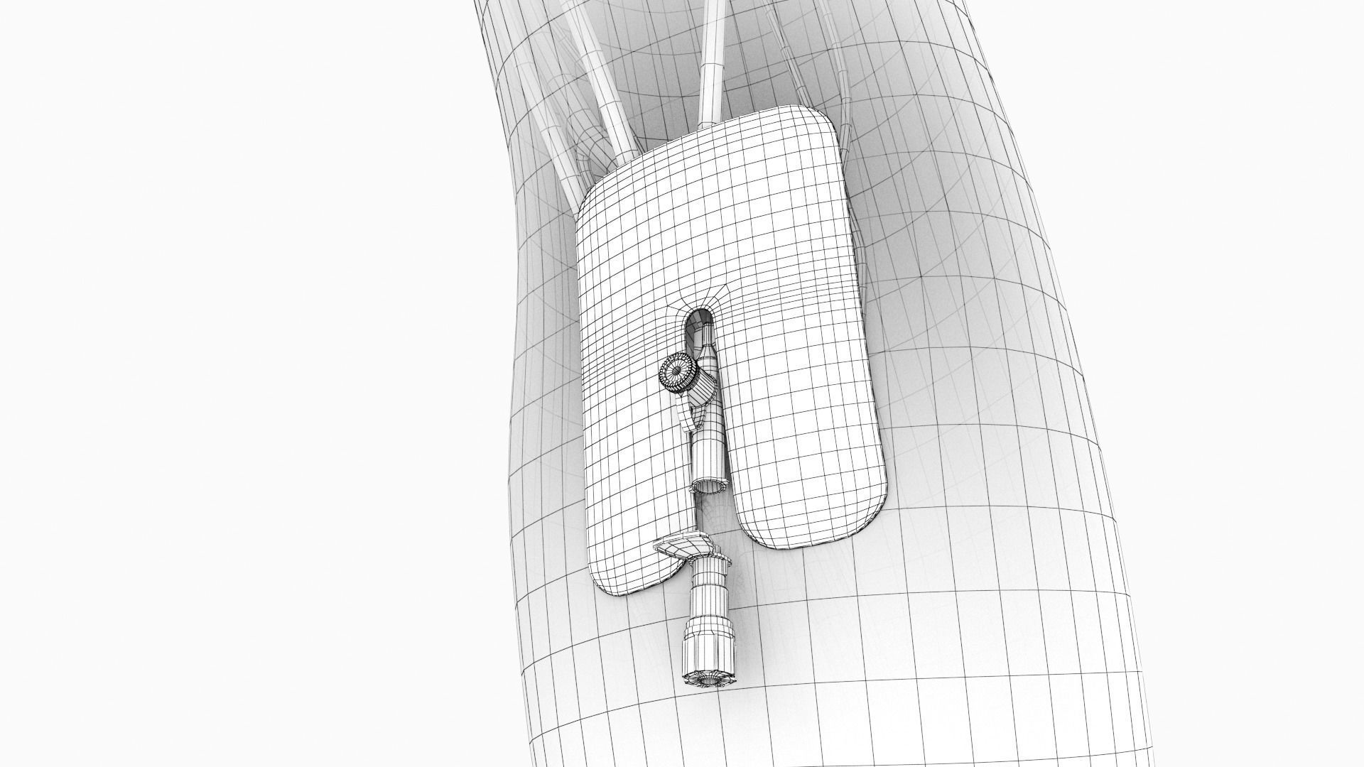 Injected Cannula with sticking plaster Low-poly 3D model_17