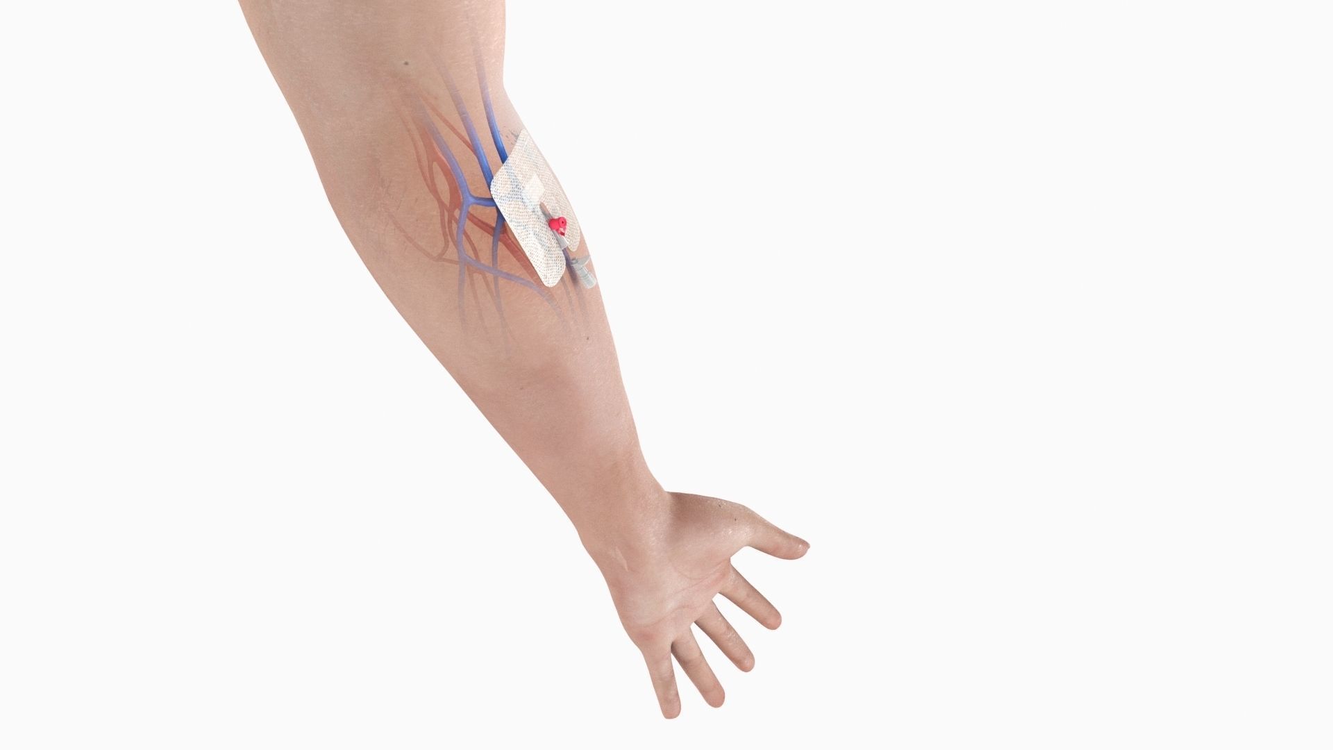 Injected Cannula with sticking plaster Low-poly 3D model_3