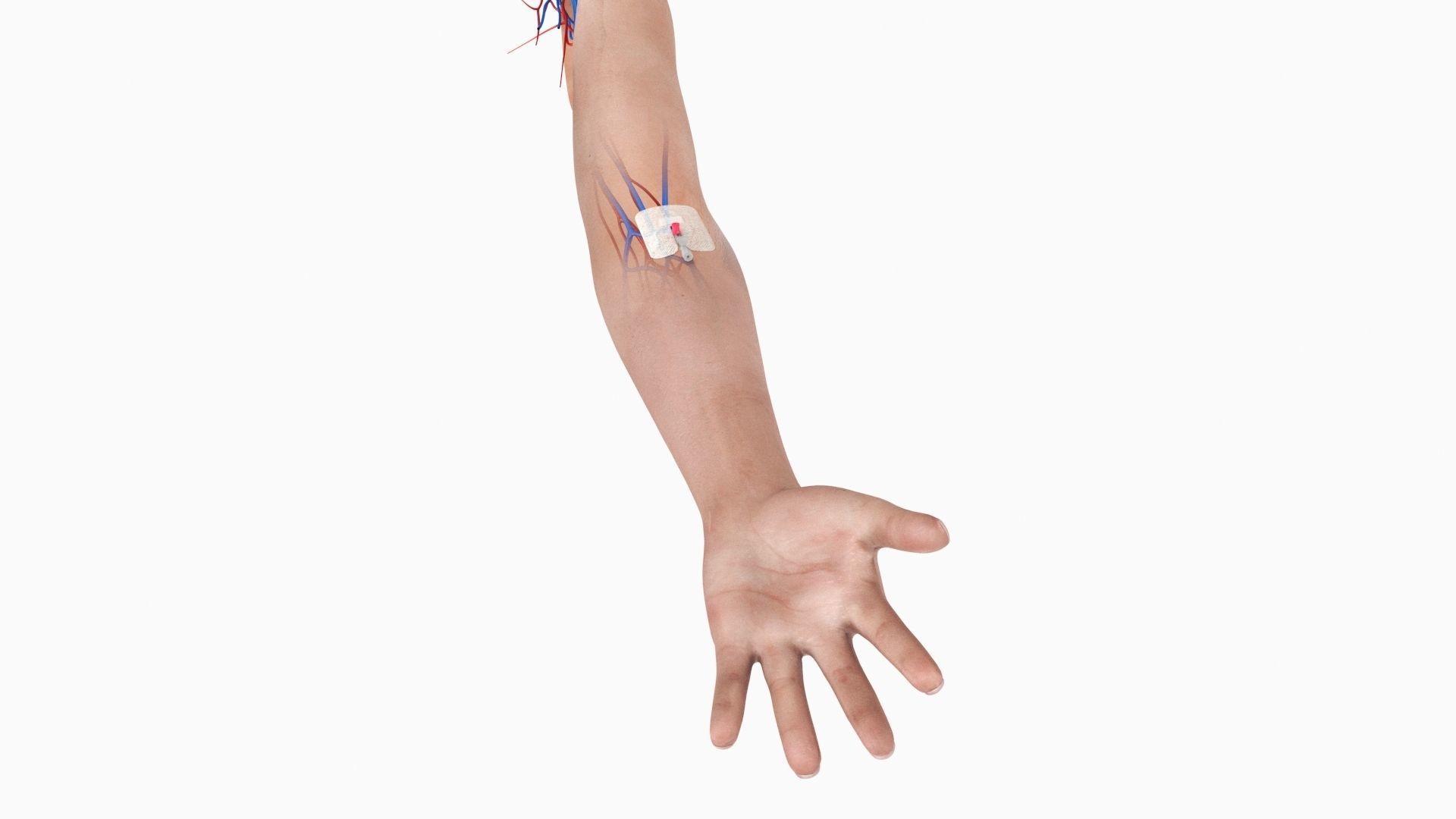 Injected Cannula with sticking plaster Low-poly 3D model_4