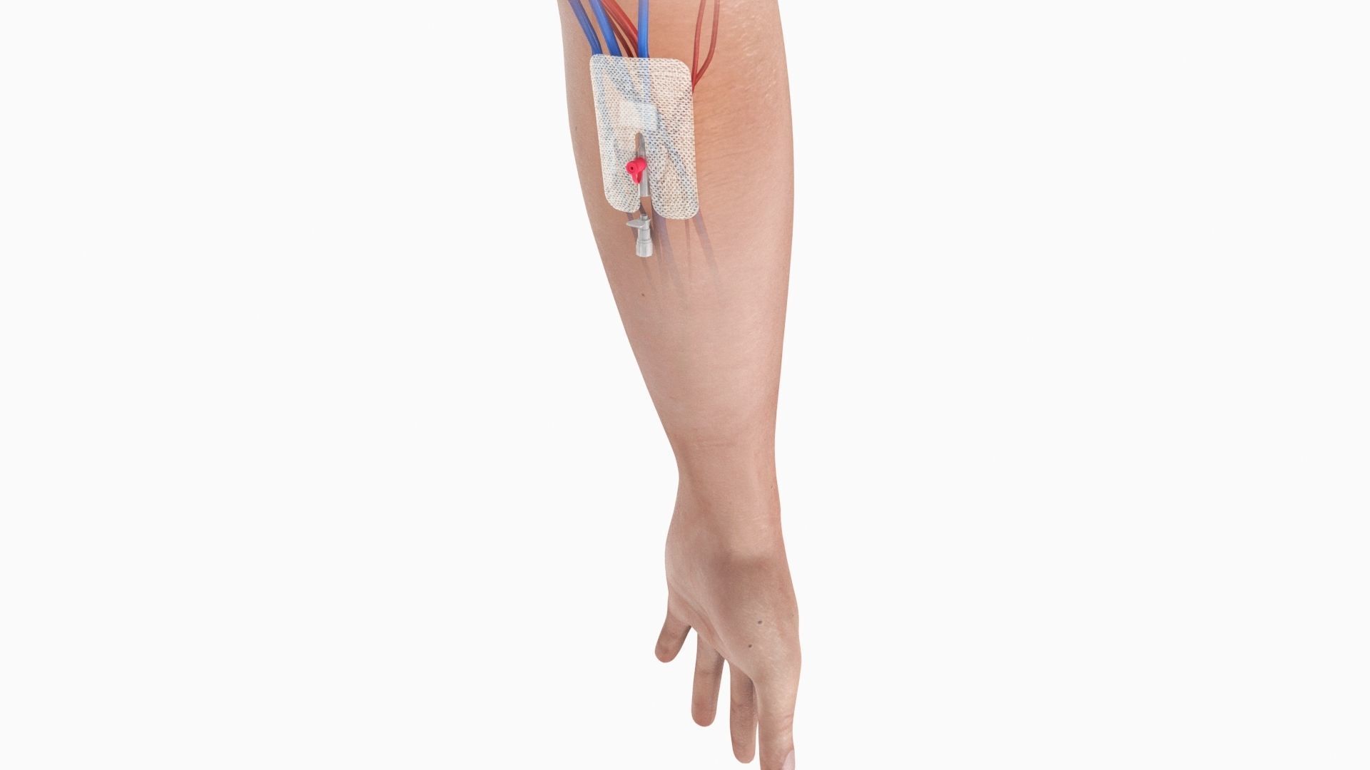 Injected Cannula with sticking plaster Low-poly 3D model_5