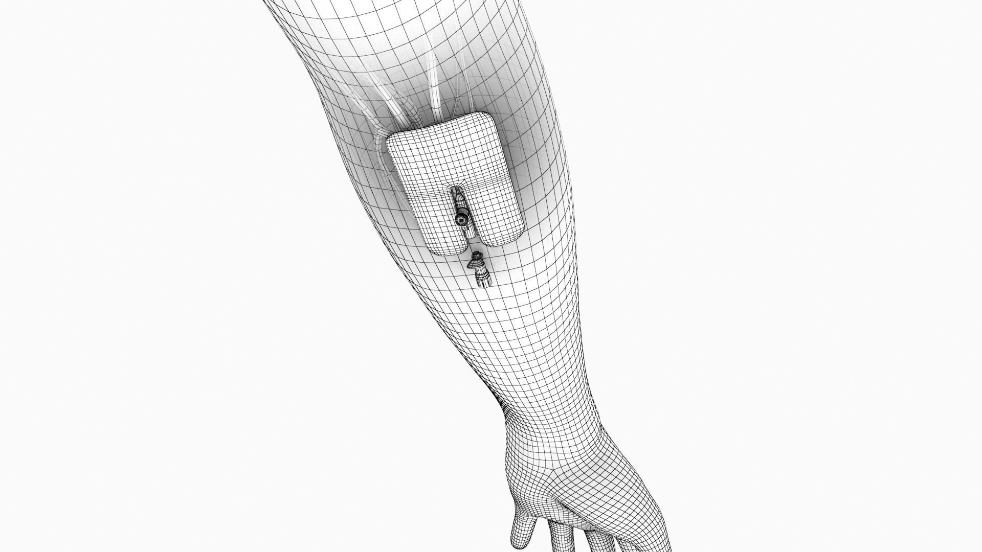 Injected Cannula with sticking plaster Low-poly 3D model_11